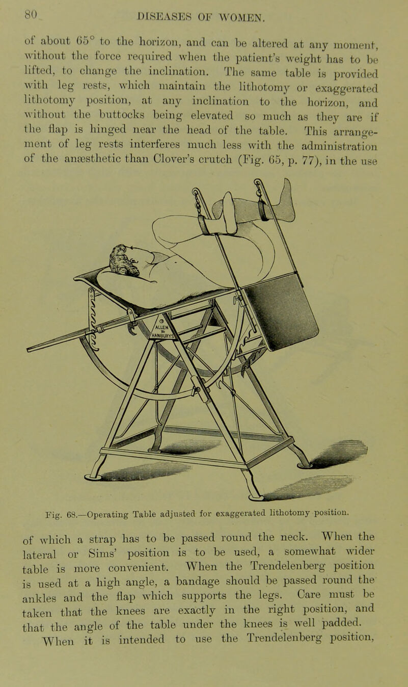 of about 65° to the horizon, and can be altered at any moment, without the force required when the patient's weight has to be lifted, to change the inclination. The same table is provided with leg rests, which maintain the lithotomy or exaggerated lithotomy position, at any inclination to the horizon, and without the buttocks being elevated so much as they are if the flap is hinged near the head of the table. This arrange- ment of leg rests interferes much less with the administration of the ana3sthetic than Clover's crutch (Fig. 65, p. 77), in the use Fig. 63.—Operating Table adjusted for exaggerated lithotomy position. of which a strap has to be passed round the neck. When the lateral or Sims' position is to be used, a somewhat wider table is more convenient. When the Trendelenberg position is used at a high angle, a bandage should be passed round the ankles and the flap which supports the legs. Care must be taken that the knees are exactly in the right position, and that the angle of the table under the knees is well padded. When it is intended to use the Trendelenberg position,