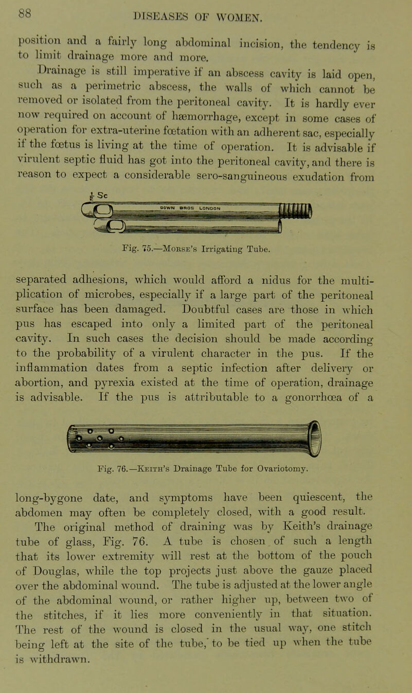 position and a fairljr long abdominal incision, the tendency is to limit drainage more and more. Drainage is still imperative if an abscess cavity is laid open, such as a perimetric abscess, the walls of which cannot be removed or isolated from the peritoneal cavity. It is hardly ever now required on account of haemorrhage, except in some cases of operation for extra-uterine foetation with an adherent sac, especially if the foetus is living at the time of operation. It is advisable if virulent septic fluid has got into the peritoneal cavity, and there is reason to expect a considerable sero-sanguineous exudation from Fig. 75.—Mobse's Irrigating Tube. separated adhesions, which would afford a nidus for the multi- plication of microbes, especiall}^ if a large part of the peritoneal surface has been damaged. Doubtful cases are those in which pus has escaped into only a limited part of the peritoneal cavity. In such cases the decision should be made according to the probability of a virulent character in the pus. If the inflammation dates from a septic infection after delivery or abortion, and pyrexia existed at the time of operation, drainage is advisable. If the pus is attributable to a gonorrhoea of a Fig. 76.—Keith's Drainage Tube for Ovariotomy. long-bygone date, and symptoms have been quiescent, the abdomen may often be completely closed, with a good result. The original method of draining was by Keith's drainage tube of glass. Fig. 76. A tube is chosen of such a length that its lower extremity will rest at the bottom of the pouch of Douglas, while the top projects just above the gauze placed over the abdominal wound. The tube is adjusted at the lower angle of the abdominal wound, or rather higher up, between two of the stitches, if it lies more conveniently in that situation. The rest of the wound is closed in the usual way, one stitch being left at the site of the tube,' to be tied up when the tube is withdrawn.