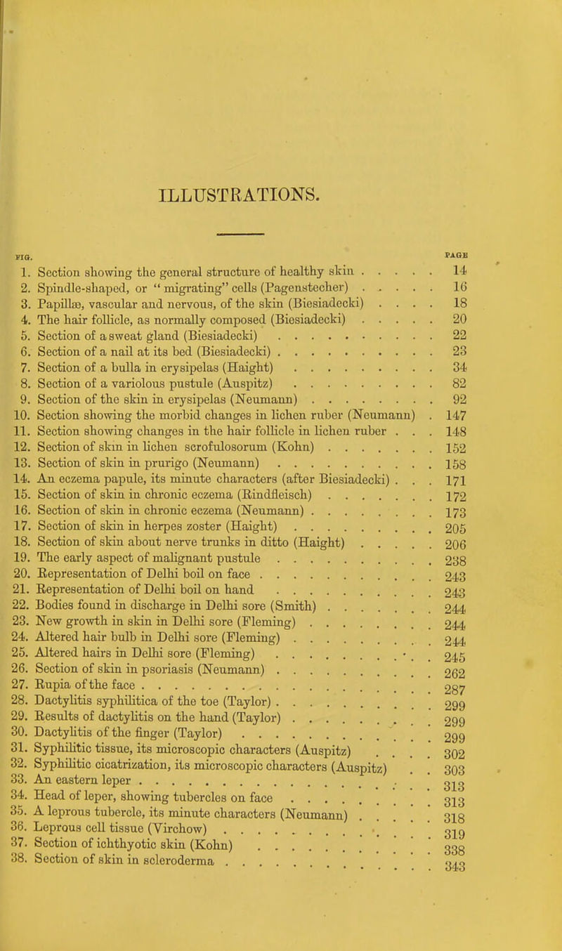 FIG, Si<»E 1. Section showing the general structure of healthy skin 14 2. Spindle-shaped, or  migrating cells (Pagenstecher) 16 3. Papillaa, vascular and nervous, of the skin (Biesiadecki) .... 18 4. The hair follicle, as normally composed (Biesiadecki) 20 5. Section of a sweat gland (Biesiadecki) 22 6. Section of a nail at its bed (Biesiadecki) 23 7. Section of a bulla in erysipelas (Haight) 34 8. Section of a variolous pustule (Auspitz) 82 9. Section of the skin in erysipelas (Neumann) 92 10. Section showing the morbid changes in lichen ruber (Neumann) . 147 11. Section showing changes in the hair follicle in lichen ruber . . . 148 12. Section of skm in lichen scrofulosorum (Kohn) 152 13. Section of skin in prurigo (Neumann) 158 14. An eczema papule, its minute characters (after Biesiadecki) . . . 171 15. Section of skin in chronic eczema (Rindfleisch) 172 16. Section of skin in chronic eczema (Neumann) I73 17. Section of skin in herpes zoster (Haight) 205 18. Section of skin about nerve trunks in ditto (Haight) 206 19. The early aspect of malignant pustule 238 20. Representation of Delhi boil on face 243 21. Representation of Delhi boil on hand 243 22. Bodies found in discharge in Delhi sore (Smith) 244 23. New growth in skin in Delhi sore (Fleming) 244 24. Altered hair bulb in Delhi sore (Fleming) 244 25. Altered hairs in Delhi sore (Fleming) • _ 245 26. Section of skin in psoriasis (Neumann) 262 27. Rupia of the face 287 28. Dactylitis syphilitica of the toe (Taylor) 299 29. Results of dactylitis on the hand (Taylor) 299 30. Dactylitis of the finger (Taylor) 299 31. Syphilitic tissue, its microscopic characters (Auspitz) . 302 32. Syphilitic cicatrization, its microscopic characters (Auspitz) . 303 33. An eastern leper 34. Head of leper, showing tubercles on face 3^3 35. A leprous tubercle, its minute characters (Neumann) . . . 318 36. Leprous cell tissue (Virchow) _ ^ig 37. Section of ichthyotic skin (Kohn) ' ggg 38. Section of skin in scleroderma