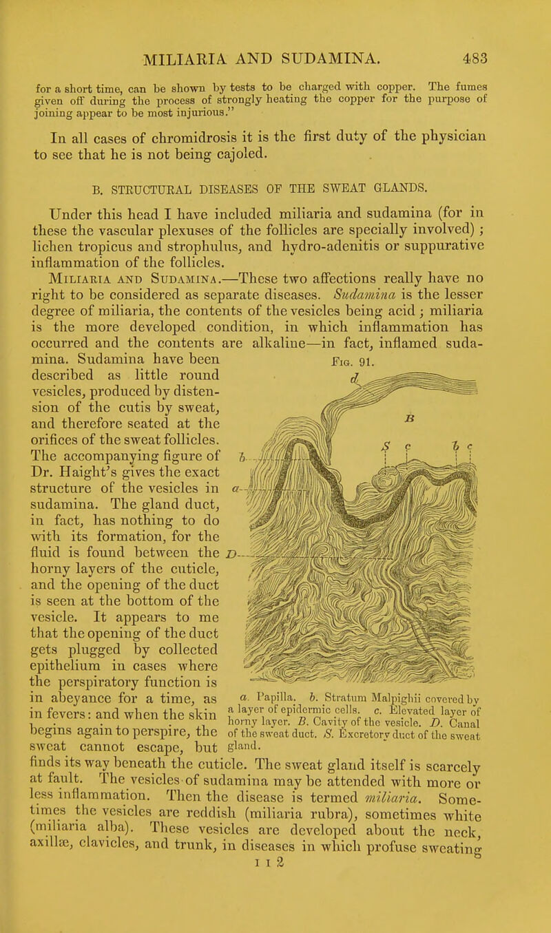 for a short time, can be shown by tests to be charged with copper. The fumes given ofi' during the process of strongly heating the copper for the purpose of joining appear to be most injurious. In all cases of chromidrosis it is the first duty of the physician to see that he is not being cajoled. B. STEUCTUEAL DISEASES OF THE SWEAT GLANDS. Under this head I have included miliaria and sudamina (for in these the vascular plexuses of the follicles are specially involved) ; lichen tropicus and strophulus, and hydro-adenitis or suppurative inflammation of the follicles. Miliaria and Sudamina.—These two affections really have no right to be considered as separate diseases. Sudamina is the lesser degree of miliaria, the contents of the vesicles being acid ; miliaria is the more developed condition, in which inflammation has occurred and the contents are alkaline—in fact, inflamed suda- mina. Sudamina have been p1Q. 91. described as little round vesicles, produced by disten- sion of the cutis by sweat, and therefore seated at the orifices of the sweat follicles. The accompanying figure of Dr. Haight's gives the exact structure of the vesicles in sudamina. The gland duct, in fact, has nothing to do with its formation, for the fluid is found between the D- horny layers of the cuticle, and the opening of the duct is seen at the bottom of the vesicle. It appears to me that the opening of the duct gets plugged by collected epithelium in cases where the perspiratory function is in abeyance for a time, as a Papilla, b. Stratum Malpigliii coveredbv in fevers: and when the skin ? layer,of ePidne™io <»■; * Elevated layer of 1 . . ,, horny layer. #. Cavity of the vesicle. D. Canal begins again to perspire, the of the sweat duct. S. Excretory duct of the sweat sweat cannot escape, but gland. finds its way beneath the cuticle. The sweat gland itself is scarcely at fault. The vesicles of sudamina may be attended with more or less inflammation. Then the disease is termed miliaria. Some- times the vesicles are reddish (miliaria rubra), sometimes white (miliaria alba). These vesicles are developed about the neck, axillae, clavicles, and trunk, in diseases in which profuse sweating