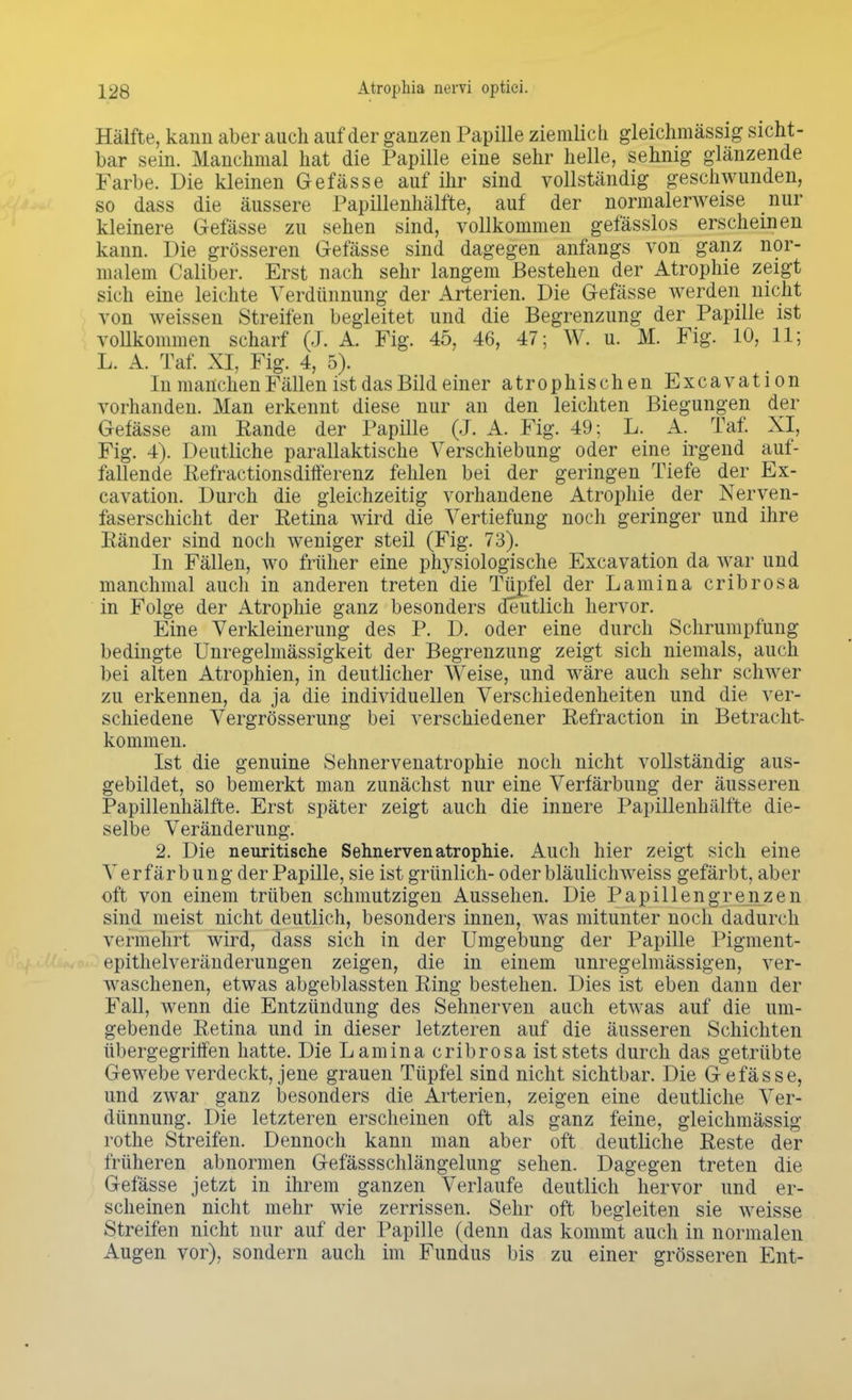 Hälfte, kann aber auch auf der ganzen Papille ziemlich gleichmässig sicht- bar sein. Manchmal hat die Papille eine sehr helle, sehnig glänzende Farbe. Die kleinen Gefässe auf ihr sind vollständig geschwunden, so dass die äussere Papillenhälfte, auf der normalerweise nur kleinere Gefässe zu sehen sind, vollkommen gefässlos erscheinen kann. Die grösseren Gefässe sind dagegen anfangs von ganz nor- malem Caliber. Erst nach sehr langem Bestehen der Atrophie zeigt sich eine leichte Verdünnung der Arterien. Die Gefässe werden nicht von weissen Streifen begleitet und die Begrenzung der Papille ist vollkommen scharf (J. A. Fig. 45, 46, 47; W. u. M. Fig. 10, 11; L. A. Taf. XI, Fig. 4, 5). In manchen Fällen ist das Bild einer atrophischen Excavation vorhanden. Man erkennt diese nur an den leichten Biegungen der Gefässe am Rande der Papille (J. A. Fig. 49; L. A. Taf. XI, Fig. 4). Deutliche parallaktische Verschiebung oder eine irgend auf- fallende Refractionsdifferenz fehlen bei der geringen Tiefe der Ex- cavation. Durch die gleichzeitig vorhandene Atrophie der Nerven- faserschicht der Retina wird die Vertiefung noch geringer und ihre Ränder sind noch weniger steil (Fig. 73). In Fällen, wo früher eine physiologische Excavation da war und manchmal auch in anderen treten die Tüpfel der Lamina cribrosa in Folge der Atrophie ganz besonders deutlich hervor. Eine Verkleinerung des P. D. oder eine durch Schrumpfung bedingte Unregelmässigkeit der Begrenzung zeigt sich niemals, auch bei alten Atrophien, in deutlicher Weise, und wäre auch sehr schwer va\ erkennen, da ja die individuellen Verschiedenheiten und die ver- schiedene Vergrösserung bei verschiedener Refraction in Betracht- kommen. Ist die genuine Sehnervenatrophie noch nicht vollständig aus- gebildet, so bemerkt man zunächst nur eine Verfärbung der äusseren Papillenhälfte. Erst später zeigt auch die innere Papillenhälfte die- selbe Veränderung. 2. Die neuritische Sehnervenatrophie. Auch hier zeigt sich eine Verfärbung der Papille, sie ist grünlich- oderbläulichweiss gefärbt, aber oft von einem trüben schmutzigen Aussehen. Die Papillengrenzen sind meist nicht deutlich, besonders innen, was mitunter noch dadurch vermehrt wird, dass sich in der Umgebung der Papille Pigment- epithelveränderungen zeigen, die in einem unregelmässigen, ver- waschenen, etwas abgeblassten Ring bestehen. Dies ist eben dann der Fall, wenn die Entzündung des Sehnerven auch etwas auf die um- gebende Retina und in dieser letzteren auf die äusseren Schichten übergegriffen hatte. Die Lamina cribrosa ist stets durch das getrübte Gewebe verdeckt, jene grauen Tüpfel sind nicht sichtbar. Die Gefässe, und zwar ganz besonders die Arterien, zeigen eine deutliche Ver- dünnung. Die letzteren erscheinen oft als ganz feine, gleichmässig rothe Streifen. Dennoch kann man aber oft deutliche Reste der früheren abnormen Gefässschlängelung sehen. Dagegen treten die Gefässe jetzt in ihrem ganzen Verlaufe deutlich hervor und er- scheinen nicht mehr wie zerrissen. Sehr oft begleiten sie weisse Streifen nicht nur auf der Papille (denn das kommt auch in normalen Augen vor), sondern auch im Fundus bis zu einer grösseren Ent-