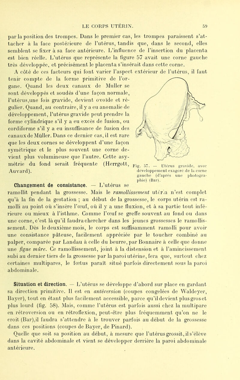 par la position des trompes. Dans le premier cas, les trompes paraissent s'at- tacher à la face postérieure de l'utérus, tandis que, dans le second, elles semblent se fixer à sa face antérieure. L'influence de l'insertion du placenta est bien réelle. L'utérus que représente la figure 57 avait une corne gauche très développée, et précisément le placenta s'insérait dans cette corne. A côté de ces facteurs qui font varier l'aspect extérieur de l'utérus, il faut tenir compte de la forme primitive de l'or- gane. Quand les deux canaux de Muller se sont développés et soudés d'une façon normale, l'utérus,une fois gravide, devient ovoïde et ré- gulier. Quand, au contraire, il y a eu anomalie de développement, l'utérus gravide peut prendre la forme cylindrique s'il y a eu excès de fusion, ou cordiforme s'il y a eu insuffisance de fusion des canaux de Miiller. Dans ce dernier cas, il est rare que les deux cornes se développent d'une façon symétrique et le plus souvent une corne de- vient plus volumineuse que l'autre. Cette asy- métrie du fond serait fréquente (Herrgott, Fig. 57 utérus gravide, avec Auvard). développement exagéré de la corne gauche (d'après une photogra- phie) (Bar). Changement de consistance. — L'utérus se ramollit pendant la grossesse. Mais le ramollissement utérin n'est complet qu'à la fin de la gestation ; au début de la grossesse, le corps utérin est ra- molli au point où s'insère l'œuf, où il y a une fluxion, et à sa partie tout infé- rieure ou mieux à l'isthme. Comme l'œuf se greffe souvent au fond ou dans une corne, c'est là qu'il faudra chercher dans les jeunes grossesses le ramollis- sement. Dès le deuxième mois, le corps est suffisamment ramolli pour avoir une consistance pâteuse, facilement appréciée par le toucher combiné au palper, comparée par Landau à celle du beurre, par Bonnaire à celle que donne une figue mûre. Ce ramollissement, joint à la distension et à l'amincissement subi au dernier tiers de la grossesse par la paroi utérine, fera que, surtout chez certaines multipares, le fœtus paraît situé parfois directement sous la paroi abdominale. Situation et direction. — L'utérus se développe d'abord sur place en gardant sa direction primitive. Il est en antéversion (coupes congelées de Waldeyer, Bayer), tout en étant plus facilement accessible, parce qu'il devient plus gros et plus lourd (fig. 58). Mais, comme l'utérus est parfois aussi chez la multipare en rétroversion ou en rétroflexion, peut-être plus fréquemment qu'on ne le croit (Bar),il faudra s'attendre à le trouver parfois au début de la grossesse dans ces positions (coupes de Bayer, de Pinard). Quelle que soit sa position au début, à mesure que l'utérus grossit, il s'élève dans la cavité abdominale et vient se développer derrière la paroi abdominale antérieure.