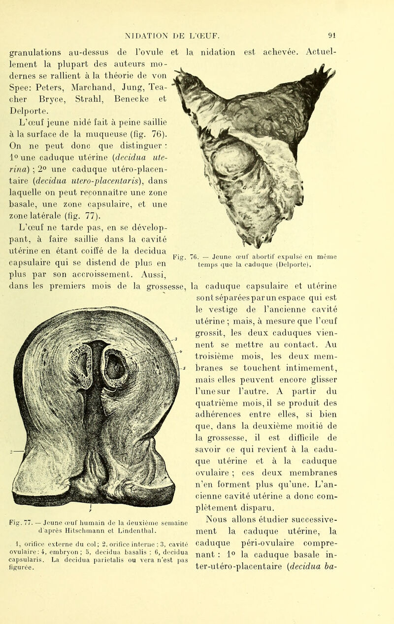 76. — Jeune œuf abortif expulsé en même temps que la caduque (Delporte). granulations au-dessus de l'ovule et la nidation est achevée. Actuel- lement la plupart des auteurs mo- dernes se rallient à la théorie de von Spee: Peters, Marchand, Jung, Tea- cher Bryce, Strahl, Benecke et Delporte. L'œuf jeune nidé fait à peine saillie à la surface de la muqueuse (fig. 76). On ne peut donc que distinguer : 1° une caduque utérine (decidua ute- rina) \ 2° une caduque utéro-placen- taire [decidua utero-placentaris), dans laquelle on peut reconnaître une zone basale, une zone capsulaire, et une zone latérale (fig. 77). L'œuf ne tarde pas, en se dévelop- pant, à faire saillie dans la cavité utérine en étant coiffé de la decidua capsulaire qui se distend de plus en plus par son accroissement. Aussi, dans les premiers mois de la grossesse, la caduque capsulaire et utérine sontséparéesparun espace qui est le vestige de l'ancienne cavité utérine ; mais, à mesure que l'œuf grossit, les deux caduques vien- nent se mettre au contact. Au troisième mois, les deux mem- branes se touchent intimement, mais elles peuvent encore glisser l'une sur l'autre. A partir du quatrième mois, il se produit des adhérences entre elles, si bien que, dans la deuxième moitié de la grossesse, il est difficile de savoir ce qui revient à la cadu- que utérine et à la caduque ovulaire ; ces deux membranes n'en forment plus qu'une. L'an- cienne cavité utérine a donc com- plètement disparu. Nous allons étudier successive- ment la caduque utérine, la caduque péri-ovulaire compre- Fig. 77. — Jeune œuf humain de la deuxième semaine d'après Hitschmann et Lindenthal. 1, orifice externe du col; 2, orifice interne ; 3, cavité ovulaire : 4. embryon ; 5, decidua basalis : 6 decidua nfmt . {0 Ja cadUque basale in- capsularis. La decidua panetalis ou vera n est pas , . 1 figurée ter-utéro-placentaire (decidua ba-