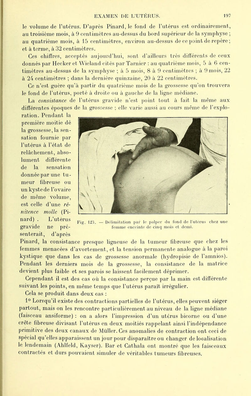 le volume de l'utérus. D'après Pinard, le fond de l'utérus est ordinairement, au troisième mois, à 9 centimètres au-dessus du bord supérieur de la symphyse ; au quatrième mois, à 15 centimètres, environ au-dessus de ce point de repère; et à terme, à 32 centimètres. Ces chiffres, acceptés aujourd'hui, sont d'ailleurs très différents de ceux donnés par Hecker et Wieland cités par Tanner : au quatrième mois, 5 à 6 cen- timètres au-dessus de la symphyse ; à 5 mois, 8 à 9 centimètres ; à 9 mois, 22 à 24 centimètres ; dans la dernière quinzaine, 20 à 22 centimètres. Ce n'est guère qu'à partir du quatrième mois de la grossesse qu'on trouvera le fond de l'utérus, porté à droite ou à gauche de la ligne médiane. La consistance de l'utérus gravide n'est point tout à fait la même aux différentes époques de la grossesse ; elle varie aussi au cours même de l'explo- ration. Pendant la première moitié dé la grossesse, la sen- sation fournie par l'utérus à l'état de relâchement, abso- lument différente de la sensation donnée par une tu- meur fibreuse ou un kyste de l'ovaire de même volume, est celle d'une ré- nilence molle (Pi- nard) . L'utérus gravide ne pré- senterait, d'après Pinard, la consistance presque ligneuse de la tumeur fibreuse que chez les femmes menacées d'avortement, et la tension permanente analogue à la paroi kystique que dans les cas de grossesse anormale (hydropisie de l'amnios). Pendant les derniers mois de la grossesse, la consistance de la matrice devient plus faible et ses parois se laissent facilement déprimer. Cependant il est des cas où la consistance perçue par la main est différente suivant les points, en même temps que l'utérus paraît irrégulier. Cela se produit dans deux cas : 1° Lorsqu'il existe des contractions partielles de l'utérus, elles peuvent siéger partout, mais on les rencontre particulièrement au niveau de la ligne médiane (faisceau ansiforme) : on a alors l'impression d'un utérus bicorne ou d'une crête fibreuse divisant l'utérus en deux moitiés rappelant ainsi l'indépendance primitive des deux canaux de Millier. Ces anomalies de contraction ont ceci de spécial qu'elles apparaissent un jour pour disparaître ou changer de localisation le. lendemain (Ahlfeld, Kayser). Bar et Cathala ont montré que les faisceaux contractés et durs pouvaient simuler de véritables tumeurs fibreuses. Fig. 123. — Délimitation par le palper du fond de l'utérus chez une femme enceinte de cinq mois et demi.