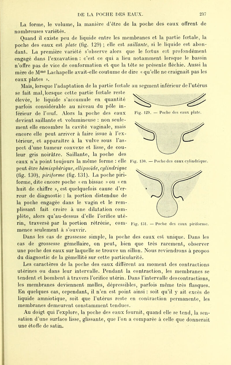 La forme, le volume, la manière d'être de la poche des eaux offrent de nombreuses variétés. Quand il existe peu de liquide entre les membranes et la partie fœtale, la poche des eaux est plate (fig. 129) ; elle est saillante, si le liquide est abon- dant. La première variété s'observe alors que le fœtus est profondément engagé dans l'excavation : c'est ce qui a lieu notamment lorsque le bassin n'offre pas de vice de conformation et que la tête se présente fléchie. Aussi la mère de Mme Lachapelle avait-elle coutume de dire « qu'elle ne craignait pas les eaux plates ». Mais, lorsque l'adaptation de la partie fœtale au segment inférieur de l'utérus se fait mal, lorsque cette partie fœtale reste élevée, le liquide s'accumule en quantité parfois considérable au niveau du pôle in- férieur de l'œuf. Alors la poche des eaux Fig. 129. - Poche des eaux plate. devient saillante et volumineuse : non seule- ment elle encombre la cavité vaginale, mais encore elle peut arriver à faire issue à l'ex- térieur, et apparaître à la vulve sous l'as- pect d'une tumeur convexe et lisse, de cou- leur gris noirâtre. Saillante, la poche des eaux n'a point toujours la même forme : elle Fig. 130. — Poche des eaux cylindrique, peut être hémisphérique, ellipsoïde, cylindrique (fig. 130), pirijorme (fig. 131). La poche piri- forme, dite encore poche « en bissac » ou « en huit de chiffre », est quelquefois cause d'er- reur de diagnostic : la portion distendue de la poche engagée dans le vagin et le rem- plissant fait croire à une dilatation com- plète, alors qu'au-dessus d'elle l'orifice uté- rin, traversé par la portion rétrécie, com- Fig. 131. — Poche des eaux piriforme. mence seulement à s'ouvrir. Dans les cas de grossesse simple, la poche des eaux est unique. Dans les cas de grossesse gémellaire, on peut, bien que très rarement, observer une poche des eaux sur laquelle se trouve un sillon. Nous reviendrons à propos du diagnostic de la gémellité sur cette particularité. Les caractères de la poche des eaux diffèrent au moment des contractions utérines ou dans leur intervalle. Pendant la contraction, les membranes se tendent et bombent à travers l'orifice utérin. Dans l'intervalle des contractions, les membranes deviennent molles, dépressibles, parfois même très flasques. En quelques cas, cependant, il n'en est point ainsi : soit qu'il y ait excès de liquide amniotique, soit que l'utérus reste en contraction permanente, les membranes demeurent constamment tendues. Au doigt qui l'explore, la poche des eaux fournit, quand elle se tend, la sen- sation d'une surface lisse, glissante, que l'on a comparée à celle que donnerait une étoffe de satin.