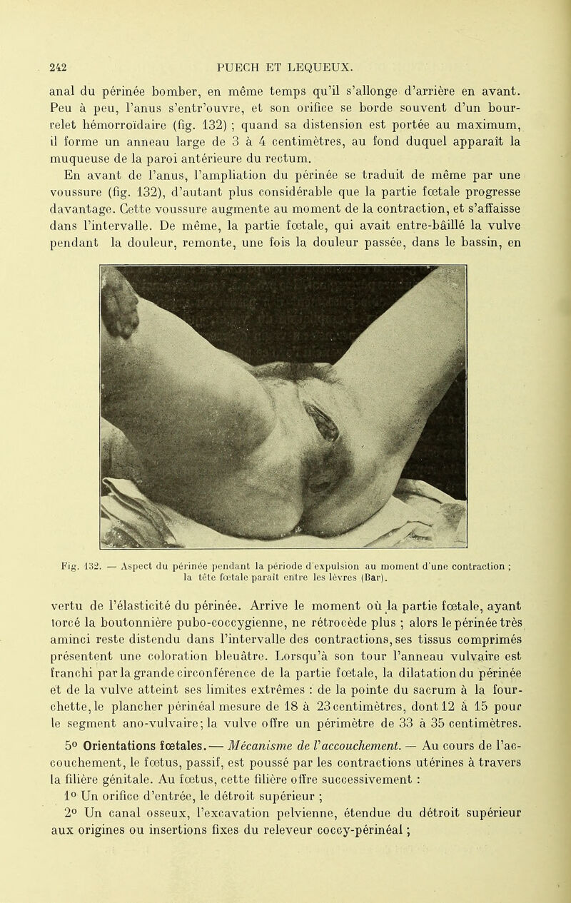 anal du périnée bomber, en même temps qu'il s'allonge d'arrière en avant. Peu à peu, l'anus s'entr'ouvre, et son orifice se borde souvent d'un bour- relet hémorroïdaire (fig. 132) ; quand sa distension est portée au maximum, il forme un anneau large de 3 à 4 centimètres, au fond duquel apparaît la muqueuse de la paroi antérieure du rectum. En avant de l'anus, l'ampliation du périnée se traduit de même par une voussure (fig. 132), d'autant plus considérable que la partie fœtale progresse davantage. Cette voussure augmente au moment de la contraction, et s'affaisse dans l'intervalle. De même, la partie foetale, qui avait entre-bâillé la vulve pendant la douleur, remonte, une fois la douleur passée, dans le bassin, en Fig. 132. — Aspect du périnée pendant la période d'expulsion au moment d'une contraction ; la tète fœtale paraît entre les lèvres (Bar). vertu de l'élasticité du périnée. Arrive le moment où la partie fœtale, ayant torcé la boutonnière pubo-coccygienne, ne rétrocède plus ; alors le périnée très aminci reste distendu dans l'intervalle des contractions, ses tissus comprimés présentent une coloration bleuâtre. Lorsqu'à son tour l'anneau vulvaire est franchi par la grande circonférence de la partie fœtale, la dilatation du périnée et de la vulve atteint ses limites extrêmes : de la pointe du sacrum à la four- chette, le plancher périnéal mesure de 18 à 23 centimètres, dont 12 à 15 pour le segment ano-vulvaire; la vulve offre un périmètre de 33 à 35 centimètres. 5° Orientations fœtales.— Mécanisme de Vaccouchement. — Au cours de l'ac- couchement, le fœtus, passif, est poussé par les contractions utérines à travers la filière génitale. Au fœtus, cette filière offre successivement : 1° Un orifice d'entrée, le détroit supérieur ; 2° Un canal osseux, l'excavation pelvienne, étendue du détroit supérieur aux origines ou insertions fixes du releveur coccy-périnéal ;