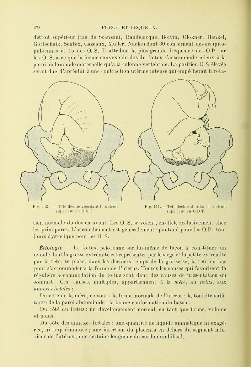 détroit supérieur (cas de Scanzoni, Baudelocque, Boivin, Glokner, Henkel, Gottschalk, Sentex, Cazeaux, Muller, Nacke) dont 30 concernent des occipito- pubiennes et 15 des 0. S. Il attribue la plus grande fréquence des O.P. sur les 0. S. à ce que la forme convexe du dos du fœtus s'accommode mieux à la paroi abdominale maternelle qu'à la colonne vertébrale. La position 0. S. élevée serait due, d'après lui, à une contraction utérine intense qui empêcherait larota- Fig. 143. — Tête fléchie abordant le détroit Fig. 144. — Tête fléchie abordant le détroit supérieur en O.G.T. supérieur en O.D.T. tion normale du dos en avant. Les 0. S. se voient, en effet, exclusivement chez les primipares. L'accouchement est généralement spontané pour les O.P., tou- jours dystocique pour les 0. S. Étiologie. — Le fœtus, pelotonné sur lui-même de façon à constituer un ovoïde dont la grosse extrémité est représentée par le siège et la petite extrémité par la tête, se place, dans les derniers temps de la grossesse, la tête en bas pour s'accommoder à la forme de l'utérus. Toutes les causes qui favorisent la régulière accommodation du fœtus sont donc des causes de présentation du sommet. Ces causes, multiples, appartiennent à la mère, au fœtus, aux annexes fœtales : Du côté de la mère, ce sont : la forme normale de l'utérus ; la tonicité suffi- sante de la paroi abdominale ; la bonne conformation du bassin. Du côté du fœtus : un développement normal, en tant que forme, volume et poids. Du côté des annexes fœtales : une quantité de liquide amniotique ni exagé- rée, ni trop diminuée ; une insertion du placenta en dehors du segment infé- rieur de l'utérus ; une certaine longueur du cordon ombilical.