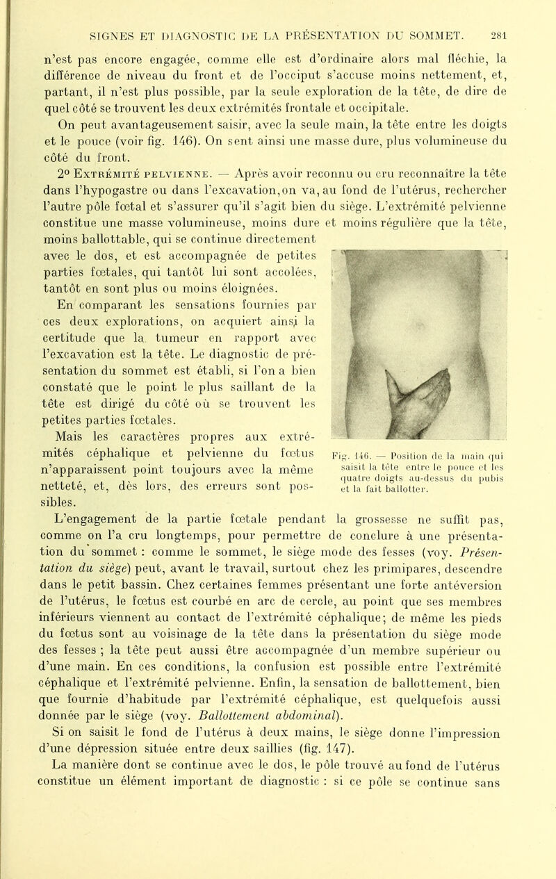 n'est pas encore engagée, comme elle est d'ordinaire alors mal fléchie, la différence de niveau du front et de l'occiput s'accuse moins nettement, et, partant, il n'est plus possible, par la seule exploration de la tête, de dire de quel côté se trouvent les deux extrémités frontale et occipitale. On peut avantageusement saisir, avec la seule main, la tète entre les doigts et le pouce (voir fig. 146). On sent ainsi une masse dure, plus volumineuse du côté du front. 2° Extrémité pelvienne. — Après avoir reconnu ou cru reconnaître la tête dans l'hypogastre ou dans l'excavation,on va, au fond de l'utérus, rechercher l'autre pôle fœtal et s'assurer qu'il s'agit bien du siège. L'extrémité pelvienne constitue une masse volumineuse, moins dure et moins régulière que la tête, moins ballottable, qui se continue directement avec le dos, et est accompagnée de petites parties foetales, qui tantôt lui sont accolées, tantôt en sont plus ou moins éloignées. En comparant les sensations fournies par ces deux explorations, on acquiert ainsi la certitude que la tumeur en rapport avec l'excavation est la tête. Le diagnostic de pré- sentation du sommet est établi, si Ton a bien constaté que le point le plus saillant de la tête est dirigé du côté où se trouvent les petites parties fœtales. Mais les caractères propres aux extré- mités céphalique et pelvienne du fœtus n'apparaissent point toujours avec la même netteté, et, dès lors, des erreurs sont pos- sibles. L'engagement de la partie fœtale pendant la grossesse ne suffit pas, comme on l'a cru longtemps, pour permettre de conclure à une présenta- tion du sommet : comme le sommet, le siège mode des fesses (voy. Présen- tation du siège) peut, avant le travail, surtout chez les primipares, descendre dans le petit bassin. Chez certaines femmes présentant une forte antéversion de l'utérus, le fœtus est courbé en arc de cercle, au point que ses membres inférieurs viennent au contact de l'extrémité céphalique; de même les pieds du fœtus sont au voisinage de la tête dans la présentation du siège mode des fesses ; la tête peut aussi être accompagnée d'un membre supérieur ou d'une main. En ces conditions, la confusion est possible entre l'extrémité céphalique et l'extrémité pelvienne. Enfin, la sensation de ballottement, bien que fournie d'habitude par l'extrémité céphalique, est quelquefois aussi donnée par le siège (voy. Ballottement abdominal). Si on saisit le fond de l'utérus à deux mains, le siège donne l'impression d'une dépression située entre deux saillies (fig. 147). La manière dont se continue avec le dos, le pôle trouvé au fond de l'utérus constitue un élément important de diagnostic : si ce pôle se continue sans Fig. 146. — Position de la main qui saisit la téte entre le pouce et les quatre doigts au-dessus du pubis et la fait ballotter.