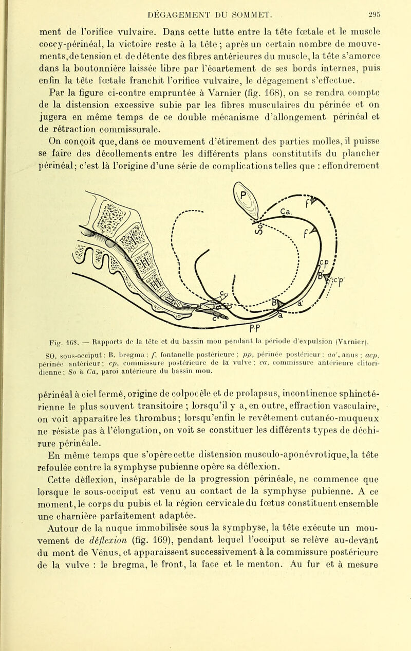 ment de l'orifice vulvaire. Dans cette lutte entre la tête fœtale et le muscle coccy-périnéal, la victoire reste à la tête ; après un certain nombre de mouve- ments, de tension et de détente des fibres antérieures du muscle, la tête s'amorce dans la boutonnière laissée libre par l'écartement de ses bords internes, puis enfin la tête fœtale franchit l'orifice vulvaire, le dégagement s'effectue. Par la figure ci-contre empruntée à Varnier (fig. 168), on se rendra compte de la distension excessive subie par les fibres musculaires du périnée et on jugera en même temps de ce double mécanisme d'allongement périnéal et de rétraction commissurale. On conçoit que, dans ce mouvement d'étirement des parties molles, il puisse se faire des décollements entre les différents plans constitutifs du plancher périnéal; c'est là l'origine d'une série de complications telles que : effondrement Fig. 168. — Rapports dp la tète et du bassin mou pendant la période dexpulsion (Varnier). SO, sous-occiput : B, bregma : f, fontanelle postérieure ; pp, périnée postérieur : aa', anus : acp, périnée antérieur; cp, commissure postérieure de la vulve: ca. commissure antérieure clitori- dienne : So à Ca, paroi antérieure du bassin mou. périnéal à ciel fermé, origine de colpocèle et de prolapsus, incontinence sphincté- rienne le plus souvent transitoire ; lorsqu'il y a, en outre, effraction vasculaire, on voit apparaître les thrombus; lorsqu'enfin le revêtement cutanéo-muqueux ne résiste pas à l'élongation, on voit se constituer les différents types de déchi- rure périnéale. En même temps que s'opère cette distension musculo-aponévrotique, la tête refoulée contre la symphyse pubienne opère sa déflexion. Cette déflexion, inséparable de la progression périnéale, ne commence que lorsque le sous-occiput est venu au contact de la symphyse pubienne. A ce moment, le corps du pubis et la région cervicale du fœtus constituent ensemble une charnière parfaitement adaptée. Autour de la nuque immobilisée sous la symphyse, la tête exécute un mou- vement de déflexion (fig. 169), pendant lequel l'occiput se relève au-devant du mont de Vénus, et apparaissent successivement à la commissure postérieure de la vulve : le bregma, le front, la face et le menton. Au fur et à mesure