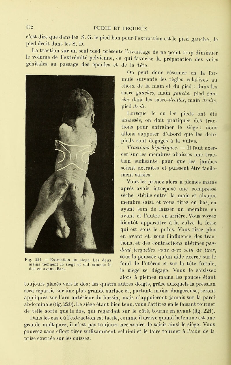 c'est dire que dans les S. G. le pied bon pour l'extraction est le pied gauche, le pied droit dans les S. D. La traction sur un seul pied présente l'avantage de ne point trop diminuer le volume de l'extrémité pelvienne, ce qui favorise la préparation des voies génitales au passage des épaules et de la tête. On peut donc résumer en la for- mule suivante les règles relatives au choix de la main et du pied : dans les sa.cro-gauches, main gauche, pied gau- che; dans les sacro-droites, main droite, pied droit. Lorsque le ou les pieds ont été abaissés, on doit pratiquer des trac- tions pour entraîner le siège ; nous allons supposer d'abord que les deux pieds sont dégagés à la vulve. Tractions bipodiques. — Il faut exer- cer sur les membres abaissés une trac- tion suffisante pour que les jambes soient extraites et puissent être facile- ment saisies. Vous les prenez alors à pleines mains après avoir interposé une compresse sèche stérile entre la main et chaque membre saisi, et vous tirez en bas, en ayant soin de laisser un membre en avant et l'autre en arrière. Vous voyez bientôt apparaître à la vulve la fesse qui est sous le pubis. Vous tirez plus en avant et, sous l'influence des trac- tions, et des contractions utérines pen- dant lesquelles vous avez soin de tirer, sous la poussée qu'un aide exerce sur le fond de l'utérus et sur la tête fœtale, le siège se dégage. Vous le saisissez alors à pleines mains, les pouces étant toujours placés vers le dos ; les quatre autres doigts, grâce auxquels la pression sera répartie sur une plus grande surface et, partant, moins dangereuse, seront appliqués sur l'arc antérieur du bassin, mais n'appuieront jamais sur la paroi abdominale (fig. 220). Le siège étant bien tenu,vous l'attirez en le faisant tourner de telle sorte que le dos, qui regardait sur le côté, tourne en avant (fig. 221). Dans les cas où l'extraction est facile, comme il arrive quand la femme est une grande multipare, il n'est pas toujours nécessaire de saisir ainsi le siège. Vous pourrez sans effort tirer suffisamment celui-ci et le faire tourner à l'aide de la prise exercée sur les cuisses. Fig. 221. — Extraction du siège. Les deux mains tiennent le siège et ont ramené le dos en avant (Bar).