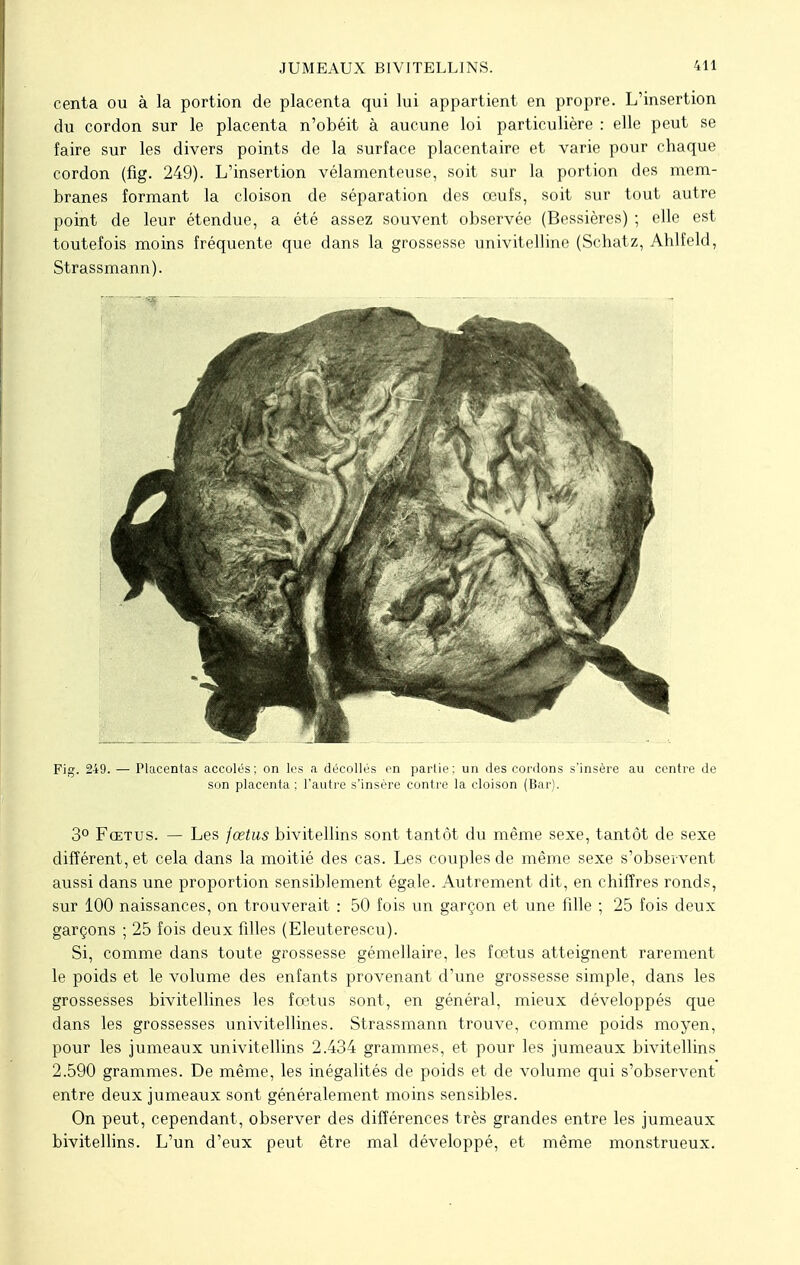 centa ou à la portion de placenta qui lui appartient en propre. L'insertion du cordon sur le placenta n'obéit à aucune loi particulière : elle peut se faire sur les divers points de la surface placentaire et varie pour chaque cordon (fig. 249). L'insertion vélamenteuse, soit sur la portion des mem- branes formant la cloison de séparation des œufs, soit sur tout autre point de leur étendue, a été assez souvent observée (Bessières) ; elle est toutefois moins fréquente que dans la grossesse univitelline (Schatz, Ahlfeld, Strassmann). Fig. 249. — Placentas accolés; on les a décollés en partie; un des cordons s'insère au centre de son placenta; l'autre s'insère contre la cloison (Bar). 3° Fœtus. — Les fœtus bivitellins sont tantôt du même sexe, tantôt de sexe différent, et cela dans la moitié des cas. Les couples de même sexe s'observent aussi dans une proportion sensiblement égale. Autrement dit, en chiffres ronds, sur 100 naissances, on trouverait : 50 fois un garçon et une fille ; 25 fois deux garçons ; 25 fois deux fdles (Eleuterescu). Si, comme dans toute grossesse gémellaire, les fœtus atteignent rarement le poids et le volume des enfants provenant d'une grossesse simple, dans les grossesses bivitellines les fœtus sont, en général, mieux développés que dans les grossesses univitellines. Strassmann trouve, comme poids moyen, pour les jumeaux univitellins 2.434 grammes, et pour les jumeaux bivitellins 2.590 grammes. De même, les inégalités de poids et de volume qui s'observent entre deux jumeaux sont généralement moins sensibles. On peut, cependant, observer des différences très grandes entre les jumeaux bivitellins. L'un d'eux peut être mal développé, et même monstrueux.