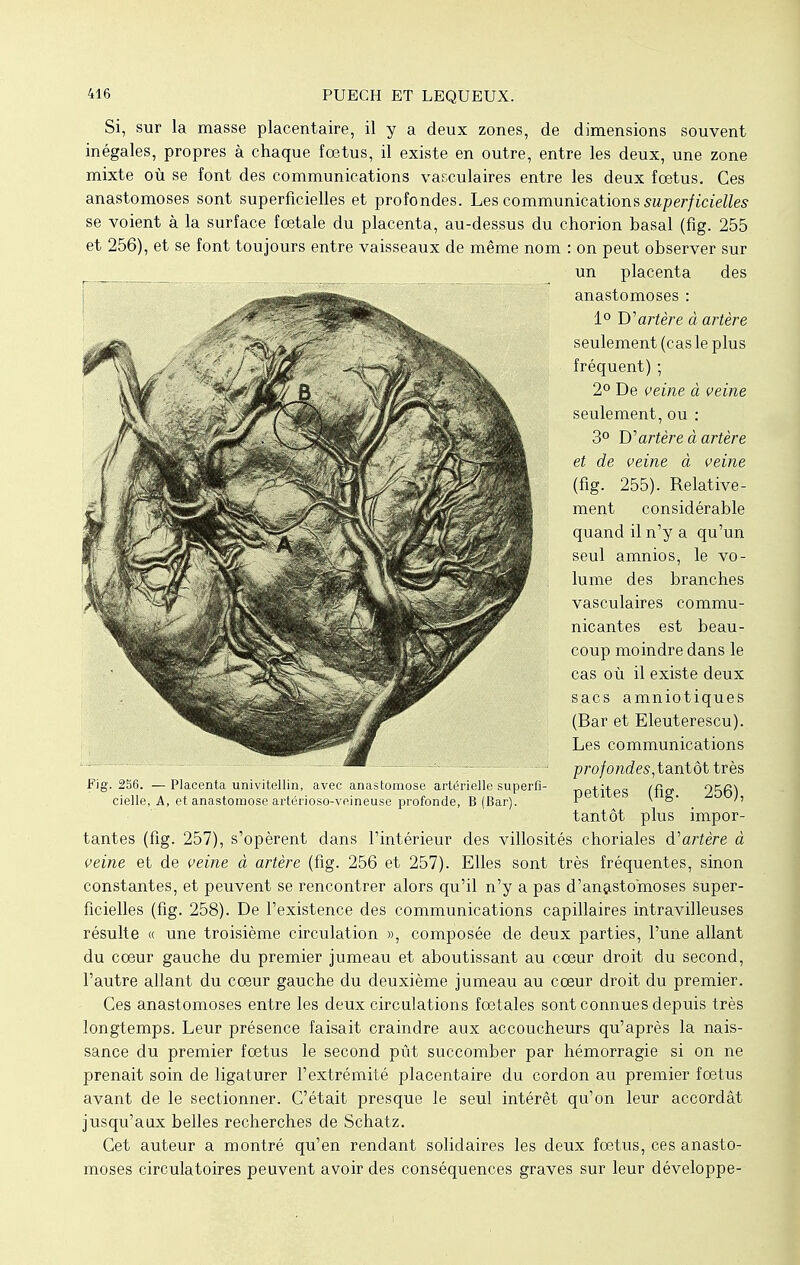 Si, sur la masse placentaire, il y a deux zones, de dimensions souvent inégales, propres à chaque fœtus, il existe en outre, entre les deux, une zone mixte où se font des communications vasculaires entre les deux fœtus. Ces anastomoses sont superficielles et profondes. Les communications superficielles se voient à la surface fœtale du placenta, au-dessus du chorion basai (fig. 255 et 256), et se font toujours entre vaisseaux de même nom : on peut observer sur un placenta des anastomoses : 1° D'artère à artère seulement (cas le plus fréquent) ; 2° De veine à veine seulement, ou : 3° W artère à artère et de veine à veine (fig. 255). Relative- ment considérable quand il n'y a qu'un seul amnios, le vo- lume des branches vasculaires commu- nicantes est beau- coup moindre dans le cas où il existe deux sacs amniotiques (Bar et Eleuterescu). Les communications profondes,tantôt très petites (fig. 256), tantôt plus impor- tantes (fig. 257), s'opèrent dans l'intérieur des villosités choriales d'artère à veine et de veine à artère (fig. 256 et 257). Elles sont très fréquentes, sinon constantes, et peuvent se rencontrer alors qu'il n'y a pas d'anastomoses super- ficielles (fig. 258). De l'existence des communications capillaires intravilleuses résulte « une troisième circulation », composée de deux parties, l'une allant du cœur gauche du premier jumeau et aboutissant au cœur droit du second, l'autre allant du cœur gauche du deuxième jumeau au cœur droit du premier. Ces anastomoses entre les deux circulations fœtales sont connues depuis très longtemps. Leur présence faisait craindre aux accoucheurs qu'après la nais- sance du premier fœtus le second pût succomber par hémorragie si on ne prenait soin de ligaturer l'extrémité placentaire du cordon au premier fœtus avant de le sectionner. C'était presque le seul intérêt qu'on leur accordât jusqu'aux belles recherches de Schatz. Cet auteur a montré qu'en rendant solidaires les deux fœtus, ces anasto- moses circulatoires peuvent avoir des conséquences graves sur leur développe- Fig. 2S6. — Placenta univitellin, avec anastomose artérielle superfi- cielle, A, et anastomose artérioso-veineuse profonde, B (Bar).