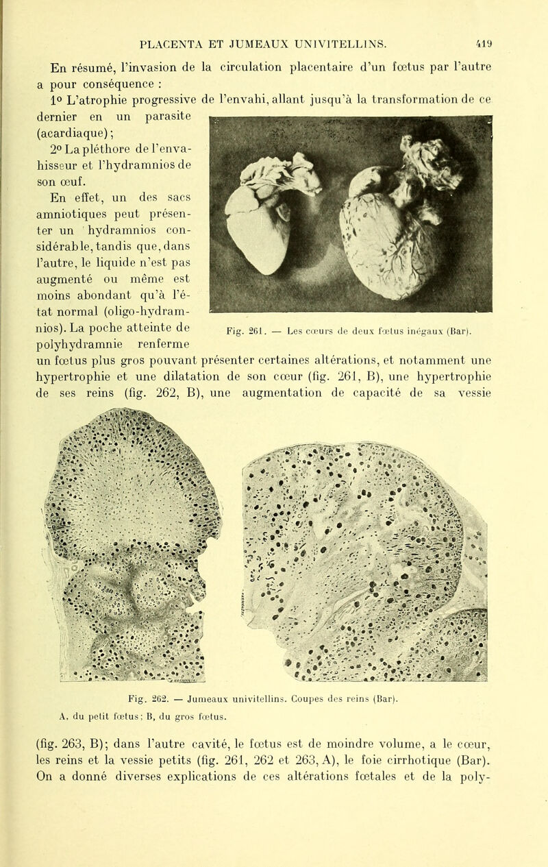 En résumé, l'invasion de la circulation placentaire d'un fœtus par l'autre a pour conséquence : 1° L'atrophie progressive de l'envahi, allant jusqu'à la transformation de ce dernier en un parasite (acardiaque) ; 2° La pléthore de l'enva- hisseur et l'hydramnios de son œuf. En effet, un des sacs amniotiques peut présen- ter un ' hydramnios con- sidérable, tandis que, dans l'autre, le liquide n'est pas augmenté ou même est moins abondant qu'à l'é- tat normal (oligo-hydram- nios).La poche atteinte de polyhydramnie renferme un fœtus plus gros pouvant présenter certaines altérations, et notamment une hypertrophie et une dilatation de son cœur (fig. 261, B), une hypertrophie de ses reins (fig. 262, B), une augmentation de capacité de sa vessie Fig. 261. — Les cœurs de deux fœtus inégaux (Bar). m; ■ -• *,» - S»? S '4 • ■..^(«##;v': Fig. 2G2. — Jumeaux univitellins. Coupes des reins (Bar). A, du petit fœtus: B, du gros fœtus. (fig. 263, B); dans l'autre cavité, le fœtus est de moindre volume, a le cœur, les reins et la vessie petits (fig. 261, 262 et 263, A), le foie cirrhotique (Bar). On a donné diverses explications de ces altérations fœtales et de la poly-