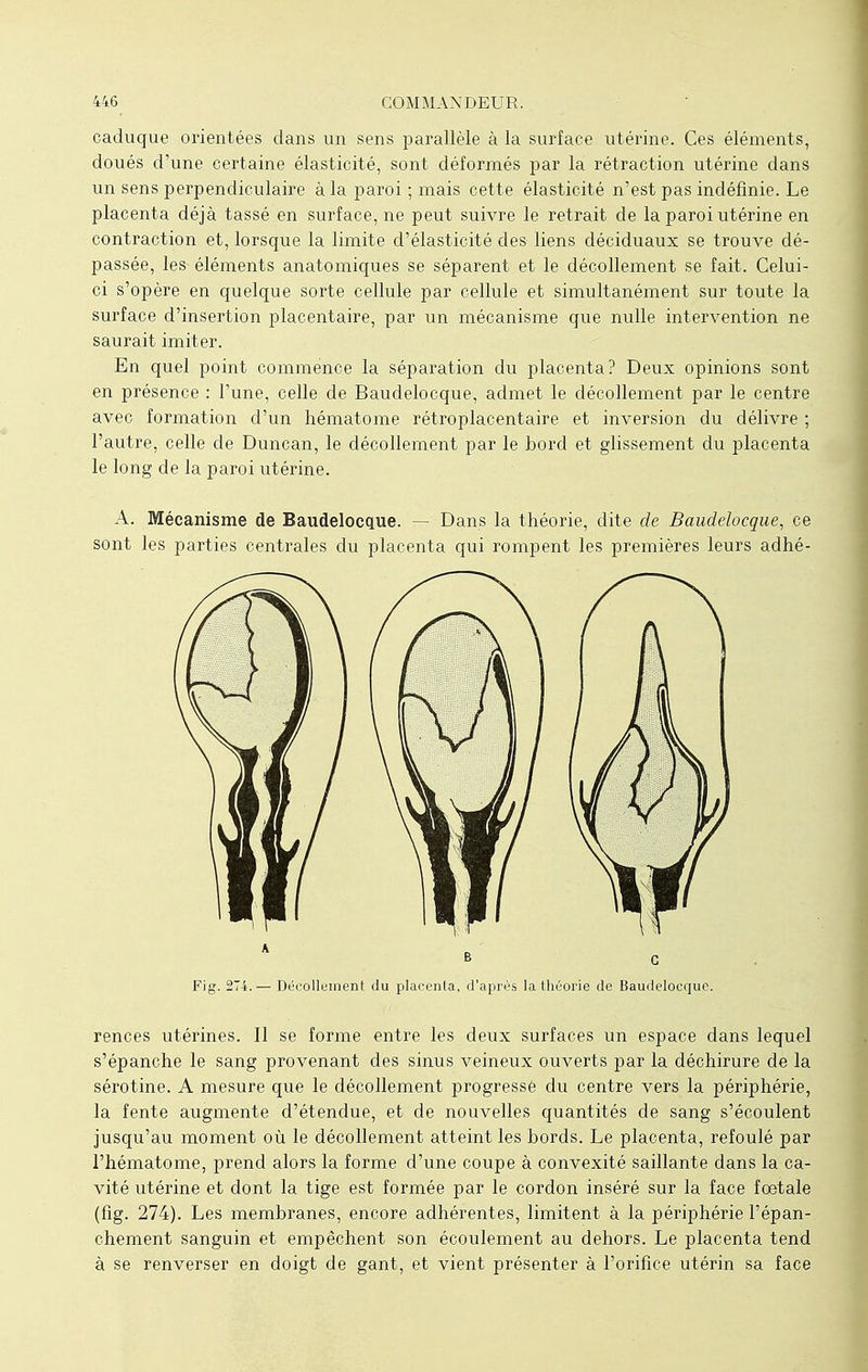 caduque orientées clans un sens parallèle à la surface utérine. Ces éléments, doués d'une certaine élasticité, sont déformés par la rétraction utérine dans un sens perpendiculaire à la paroi ; mais cette élasticité n'est pas indéfinie. Le placenta déjà tassé en surface, ne peut suivre le retrait de la paroi utérine en contraction et, lorsque la limite d'élasticité des liens déciduaux se trouve dé- passée, les éléments anatomiques se séparent et le décollement se fait. Celui- ci s'opère en quelque sorte cellule par cellule et simultanément sur toute la surface d'insertion placentaire, par un mécanisme que nulle intervention ne saurait imiter. En quel point commence la séparation du placenta? Deux opinions sont en présence : l'une, celle de Baudelocque, admet le décollement par le centre avec formation d'un hématome rétroplacentaire et inversion du délivre ; l'autre, celle de Duncan, le décollement par le bord et glissement du placenta le long de la paroi utérine. A. Mécanisme de Baudelocque. — Dans la théorie, dite de Baudelocque, ce sont les parties centrales du placenta qui rompent les premières leurs adhé- Fig. 274.— Décollement du placenta, d'après la théorie de Baudelocque. rences utérines. Il se forme entre les deux surfaces un espace dans lequel s'épanche le sang provenant des sinus veineux ouverts par la déchirure de la sérotine. A mesure que le décollement progresse du centre vers la périphérie, la fente augmente d'étendue, et de nouvelles quantités de sang s'écoulent jusqu'au moment où le décollement atteint les bords. Le placenta, refoulé par l'hématome, prend alors la forme d'une coupe à convexité saillante dans la ca- vité utérine et dont la tige est formée par le cordon inséré sur la face foetale (fig. 274). Les membranes, encore adhérentes, limitent à la périphérie l'épan- chement sanguin et empêchent son écoulement au dehors. Le placenta tend à se renverser en doigt de gant, et vient présenter à l'orifice utérin sa face