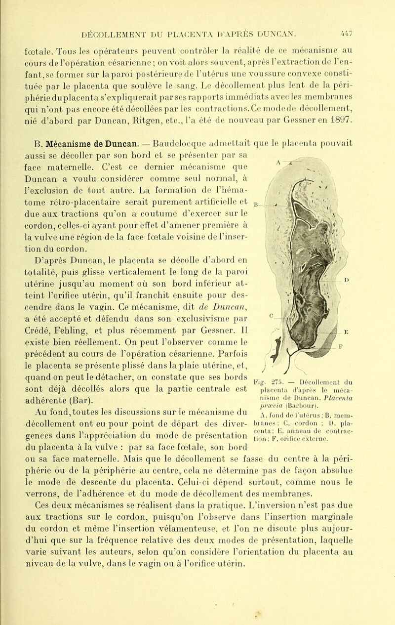 fœtale. Tous les opérateurs peuvent contrôler la réalité de ce mécanisme au cours de l'opération césarienne; on voit alors souvent, après l'extraction de l'en- fant, se former sur la paroi postérieure de l'utérus une voussure convexe consti- tuée par le placenta que soulève le sang. Le décollement plus lent de la péri- phérie du placenta s'expliquerait par ses rapports immédiats avec les membranes qui n'ont pas encore été décollées par les contractions. Ce mode de décollement, nié d'abord par Duncan, Ritgen, etc., l'a été de nouveau par Gessner en 1897. B. Mécanisme de Duncan. — Baudelocque admettait que le placenta pouvait aussi se décoller par son bord et se présenter par sa face maternelle. C'est ce dernier mécanisme que A £ ^ _ Duncan a voulu considérer comme seul normal, à l'exclusion de tout autre. La formation de l'héma- tome rétro-placentaire serait purement artificielle et due aux tractions qu'on a coutume d'exercer sur le cordon, celles-ci ayant pour effet d'amener première à la vulve une région de la face fœtale voisine de l'inser- tion du cordon. D'après Duncan, le placenta se décolle d'abord en totalité, puis glisse verticalement le long de la paroi utérine jusqu'au moment où son bord inférieur at- teint l'orifice utérin, qu'il franchit ensuite pour des- cendre dans le vagin. Ce mécanisme, dit de Duncan, a été accepté et défendu dans son exclusivisme par Crédé, Fehling, et plus récemment par Gessner. Il existe bien réellement. On peut l'observer comme le précédent au cours de l'opération césarienne. Parfois le placenta se présente plissé dans la plaie utérine, et, quand on peut le détacher, on constate que ses bords sont déjà décollés alors que la partie centrale est adhérente (Bar). Au fond, toutes les discussions sur le mécanisme du décollement ont eu pour point de départ des diver- gences dans l'appréciation du mode de présentation du placenta à la vulve : par sa face fœtale, son bord ou sa face maternelle. Mais que le décollement se fasse du centre à la péri- phérie ou de la périphérie au centre, cela ne détermine pas de façon absolue le mode de descente du placenta. Celui-ci dépend surtout, comme nous le verrons, de l'adhérence et du mode de décollement des membranes. Ces deux mécanismes se réalisent dans la pratique. L'inversion n'est pas due aux tractions sur le cordon, puisqu'on l'observe dans l'insertion marginale du cordon et même l'insertion vélamenteuse, et l'on ne discute plus aujour- d'hui que sur la fréquence relative des deux modes de présentation, laquelle varie suivant les auteurs, selon qu'on considère l'orientation du placenta au niveau de la vulve, dans le vagin ou à l'orifice utérin. Fig. 27 placenta Décollement du après le méca- nisme de Duncan. Placenta prsevia (Barbour). A, fond de l'utérus ; B, mem- branes : C, cordon ; 1), pla- centa; li. anneau de contrac- tion ; F, orifice externe.