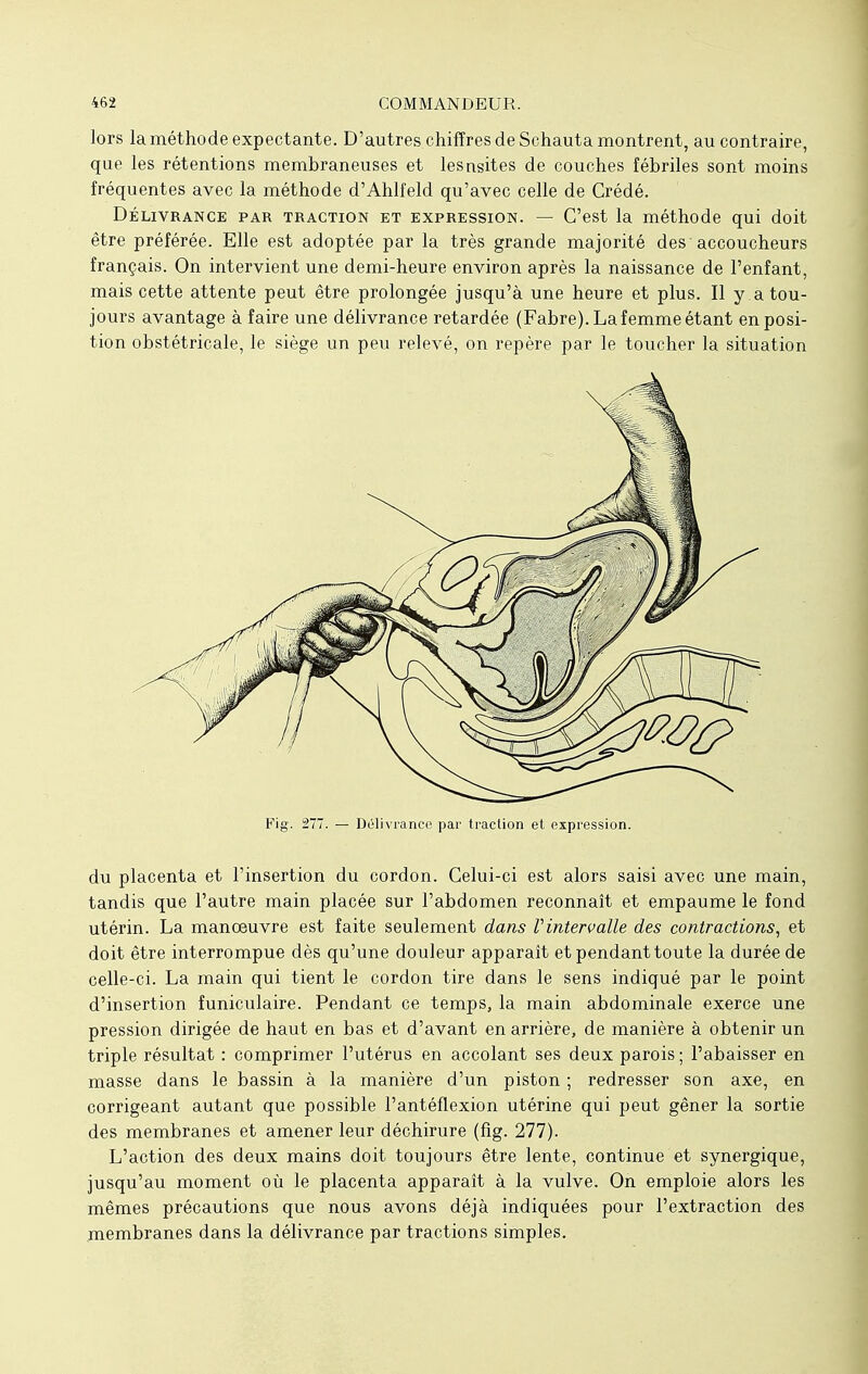 lors la méthode expectante. D'autres chiffres de Schauta montrent, au contraire, que les rétentions membraneuses et lesnsites de couches fébriles sont moins fréquentes avec la méthode d'Ahlfeld qu'avec celle de Crédé. Délivrance par traction et expression. — C'est la méthode qui doit être préférée. Elle est adoptée par la très grande majorité des accoucheurs français. On intervient une demi-heure environ après la naissance de l'enfant, mais cette attente peut être prolongée jusqu'à une heure et plus. Il y.a tou- jours avantage à faire une délivrance retardée (Fabre). La femme étant en posi- tion obstétricale, le siège un peu relevé, on repère par le toucher la situation Fig. 277. — Délivrance par traction et expression. du placenta et l'insertion du cordon. Celui-ci est alors saisi avec une main, tandis que l'autre main placée sur l'abdomen reconnaît et empaume le fond utérin. La manœuvre est faite seulement dans Vintervalle des contractions, et doit être interrompue dès qu'une douleur apparaît et pendant toute la durée de celle-ci. La main qui tient le cordon tire dans le sens indiqué par le point d'insertion funiculaire. Pendant ce temps, la main abdominale exerce une pression dirigée de haut en bas et d'avant en arrière, de manière à obtenir un triple résultat : comprimer l'utérus en accolant ses deux parois ; l'abaisser en masse dans le bassin à la manière d'un piston ; redresser son axe, en corrigeant autant que possible l'antéflexion utérine qui peut gêner la sortie des membranes et amener leur déchirure (fig. 277). L'action des deux mains doit toujours être lente, continue et synergique, jusqu'au moment où le placenta apparaît à la vulve. On emploie alors les mêmes précautions que nous avons déjà indiquées pour l'extraction des membranes dans la délivrance par tractions simples.