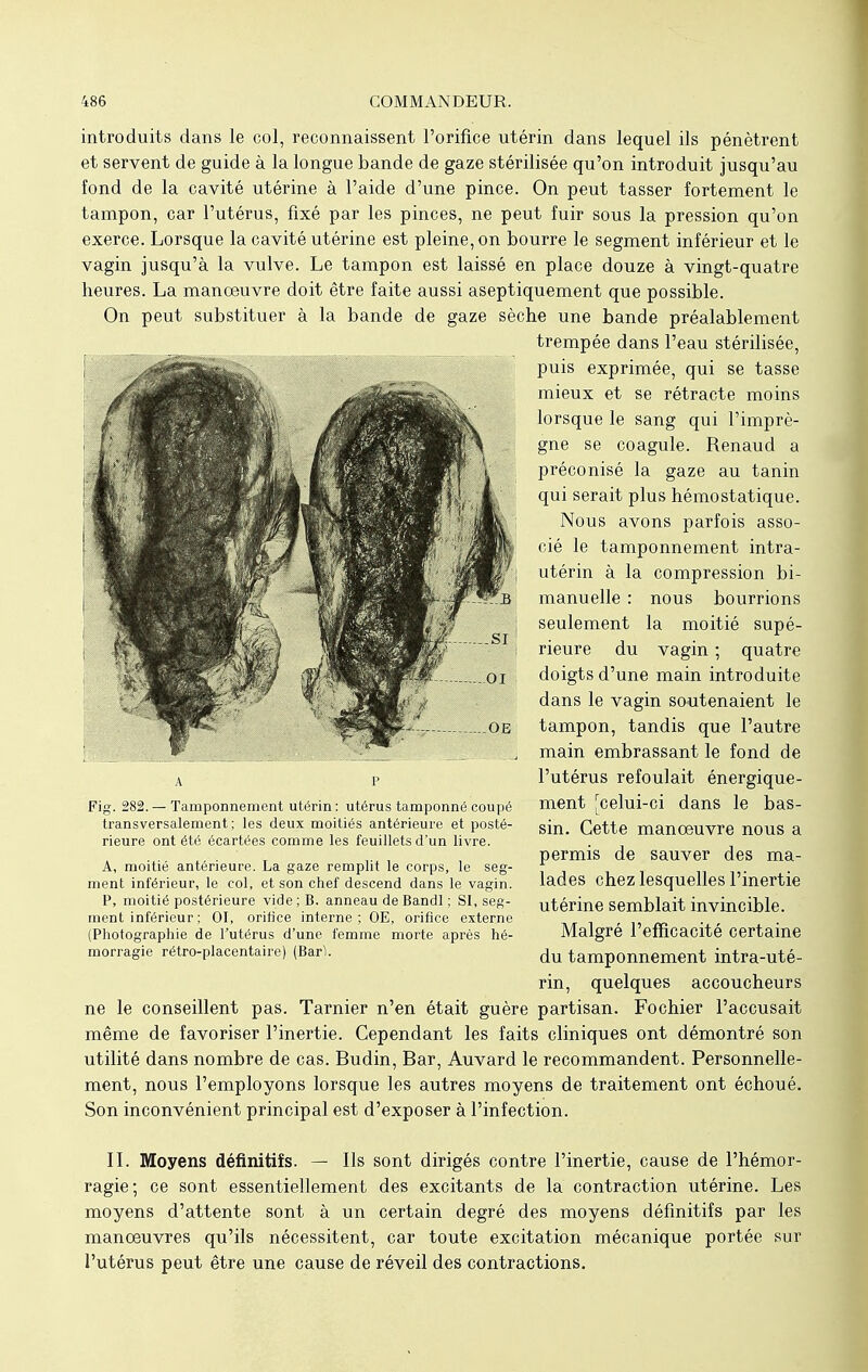 introduits dans le col, reconnaissent l'orifice utérin dans lequel ils pénètrent et servent de guide à la longue bande de gaze stérilisée qu'on introduit jusqu'au fond de la cavité utérine à l'aide d'une pince. On peut tasser fortement le tampon, car l'utérus, fixé par les pinces, ne peut fuir sous la pression qu'on exerce. Lorsque la cavité utérine est pleine, on bourre le segment inférieur et le vagin jusqu'à la vulve. Le tampon est laissé en place douze à vingt-quatre heures. La manœuvre doit être faite aussi aseptiquement que possible. On peut substituer à la bande de gaze sèche une bande préalablement trempée dans l'eau stérilisée, puis exprimée, qui se tasse mieux et se rétracte moins lorsque le sang qui l'imprè- gne se coagule. Renaud a préconisé .la gaze au tanin qui serait plus hémostatique. Nous avons parfois asso- cié le tamponnement intra- utérin à la compression bi- manuelle : nous bourrions seulement la moitié supé- rieure du vagin ; quatre doigts d'une main introduite dans le vagin soutenaient le tampon, tandis que l'autre main embrassant le fond de l'utérus refoulait énergique- ment [celui-ci dans le bas- sin. Cette manœuvre nous a permis de sauver des ma- lades chez lesquelles l'inertie utérine semblait invincible. Malgré l'efficacité certaine du tamponnement intra-uté- rin, quelques accoucheurs ne le conseillent pas. Tarnier n'en était guère partisan. Fochier l'accusait même de favoriser l'inertie. Cependant les faits cliniques ont démontré son utilité dans nombre de cas. Budin, Bar, Auvard le recommandent. Personnelle- ment, nous l'employons lorsque les autres moyens de traitement ont échoué. Son inconvénient principal est d'exposer à l'infection. II. Moyens définitifs. — Ils sont dirigés contre l'inertie, cause de l'hémor- ragie; ce sont essentiellement des excitants de la contraction utérine. Les moyens d'attente sont à un certain degré des moyens définitifs par les manœuvres qu'ils nécessitent, car toute excitation mécanique portée sur l'utérus peut être une cause de réveil des contractions. a p Fig. 282.— Tamponnement utérin: utérus tamponné coupé transversalement ; les deux moitiés antérieure et posté- rieure ont été écartées comme les feuillets d'un livre. A, moitié antérieure. La gaze remplit le corps, le seg- ment inférieur, le col, et son chef descend dans le vagin. P, moitié postérieure vide ; B. anneau de Bandl ; SI, seg- ment inférieur ; 01, orifice interne ; OE, orifice externe (Photographie de l'utérus d'une femme morte après hé- morragie rétro-placentaire) (Barl.