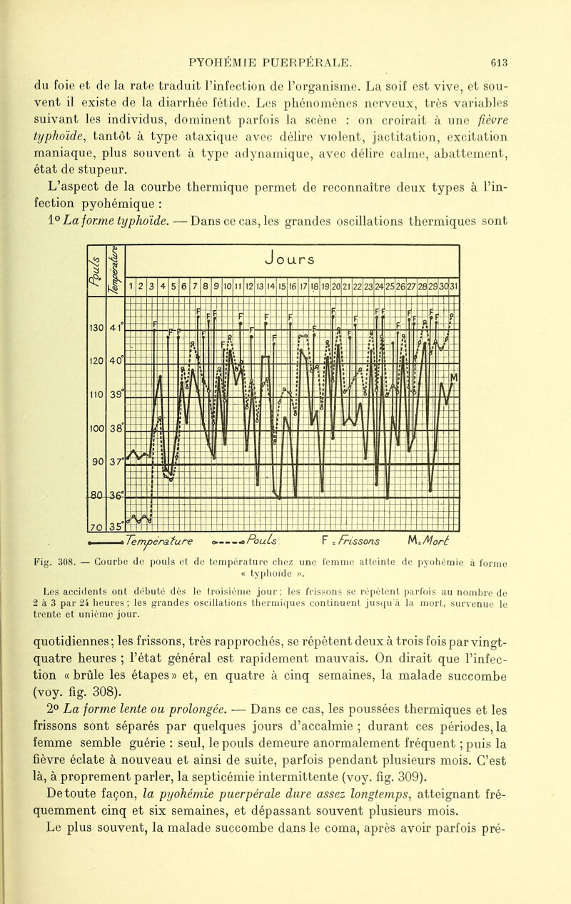 du foie et de la rate traduit l'infection de l'organisme. La soif est vive, et sou- vent il existe de la diarrhée fétide. Les phénomènes nerveux, très variables suivant les individus, dominent parfois la scène : on croirait à une fièvre typhoïde, tantôt à type ataxique avec délire violent, jactitation, excitation maniaque, plus souvent à type adynamique, avec délire calme, abattement, état de stupeur. L'aspect de la courbe thermique permet de reconnaître deux types à l'in- fection pyohémique : 1° La forme typhoïde.—Dans ce cas, les grandes oscillations thermiques sont Température » oPouls F -.Frissons tA=A!orâ Fig. 308. — Courbe de pouls et de température chez une femme atteinte de pyohémie à forme « typhoïde ». Les accidents ont débuté dès le troisième jour ; les frissons se répètent parfois au nombre de 2 à 3 par 24 heures; les grandes oscillations thermiques continuent jusqu'à la mort, survenue le trente et unième jour. quotidiennes; les frissons, très rapprochés, se répètent deux à trois fois par vingt- quatre heures ; l'état général est rapidement mauvais. On dirait que l'infec- tion «brûle les étapes» et, en quatre à cinq semaines, la malade succombe (voy. fig. 308). 2° La forme lente ou prolongée. -— Dans ce cas, les poussées thermiques et les frissons sont séparés par quelques jours d'accalmie; durant ces périodes,la femme semble guérie : seul, le pouls demeure anormalement fréquent ; puis la fièvre éclate à nouveau et ainsi de suite, parfois pendant plusieurs mois. C'est là, à proprement parler, la septicémie intermittente (voy. fig. 309). De toute façon, la pyohémie puerpérale dure assez longtemps, atteignant fré- quemment cinq et six semaines, et dépassant souvent plusieurs mois. Le plus souvent, la malade succombe dans le coma, après avoir parfois pré-