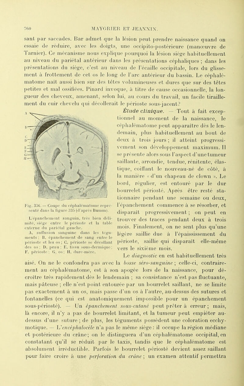 sant par saccades. Bar admet que la lésion peut prendre naissance quand on essaie de réduire, avec les doigts, une occipito-postérieure (manœuvre de Tarnier). Ce mécanisme nous explique pourquoi la lésion siège habituellement au niveau du pariétal antérieur dans les présentations céphaliques ; dans les présentations du siège, c'est au niveau de l'écaillé occipitale, lors du glisse- ment à frottement de cet os le long de l'arc antérieur du bassin. Le céphalé- matome naît aussi bien sur des têtes volumineuses et dures que sur des têtes petites et mal ossifiées. Pinard invoque, à titre de cause occasionnelle, la lon- gueur des cheveux, amenant, selon lui, au cours du travail, un facile tiraille- ment du cuir chevelu qui décollerait le périoste sous-jacent? Étude clinique. — Tout à fait excep- tionnel au moment de la naissance, le céphalématome peut apparaître dès le len- demain, plus habituellement au bout de deux à trois jours ; il atteint progressi- vement son développement maximum. Il se présente alors sous l'aspect d'une tumeur saillante, arrondie, tendue, rénitente, élas- tique, coiffant le nouveau-né de côté, à la manière « d'un chapeau de clown ». Le bord, régulier, est entouré par le dur bourrelet périosté. Après être resté sta- tionnaire pendant une semaine ou deux, Fig. 336.— Coupe du céphalématome repré- l'épanchement commence à se résorber, et senté dans la figure 335 (d'après Bumm). disparaît progressivement; on peut en L'épanchement sanguin, très bien déli- trouver des traces pendant deux à trois mité, siège entre le périoste et la table . externe du pariétal gauche. mois. Finalement, on ne sent plus qu'une A, suffusion sanguine dans les tégu- ]égère saiHie due à l'épaississement du ments ; B, epanchement de sang entre le périoste et les os ; C, périoste se décollant périoste, saillie qui disparaît elle-même des os; D, peau; E, tissu sous-dermique; yerS \q sixième mois F, périoste: G, os; H, dure-mère. ' . . Le diagnostic en est habituellement très aisé. On ne le confondra pas avec la bosse séro-sanguine ; celle-ci, contraire- ment au céphalématome, est à son apogée lors de la naissance, pour dé- croître très rapidement dès le lendemain ; sa consistance n'est pas fluctuante, mais pâteuse ; elle n'est point entourée par un bourrelet saillant, ne se limite pas exactement à un os, mais passe d'un os à l'autre, au-dessus des sutures et fontanelles (ce qui est anatomiquement impossible pour un épanchement sous-périosté). Un épanchement sous-cutané peut prêter à erreur ; mais, là encore, il n'y a pas de bourrelet limitant, et la tumeur peut empiéter au- dessus d'une suture ; de plus, les téguments possèdent une coloration ecchy- motique. — Uencéphalocèle n'a pas le même siège : il occupe la région médiane et postérieure du crâne; on le distinguera d'un céphalématome occipital, en constatant qu'il se réduit par le taxis, tandis que le céphalématome est absolument irréductible. Parfois le bourrelet périosté devient assez saillant pour faire croire à une perforation du crâne; un examen attentif permettra