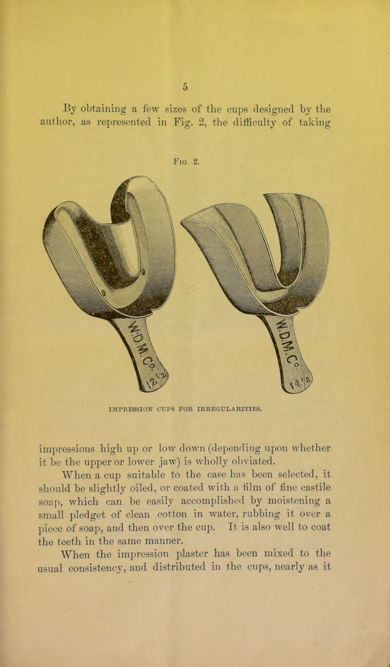 By obtaining a few sizes of the cups designed by the author, as represented in Fig. 2, the difficulty of taking Fig 2. IMPRESSION CUPS FOR IRREGULARITIES. impressions high up or low down (depending upon whether it be the upper or lower jaw) is wholly obviated. When a cup suitable to the case has been selected, it should be slightly oiled, or coated with a film of tine castile soap, which can be easily accomplished by moistening a small pledget of clean cotton in water, rubbing it over a piece of soap, and then over the cup. It is also well to coat the teeth in the same manner. When the impression plaster has been mixed to the usual consistency, and distributed in the cups, nearly as it