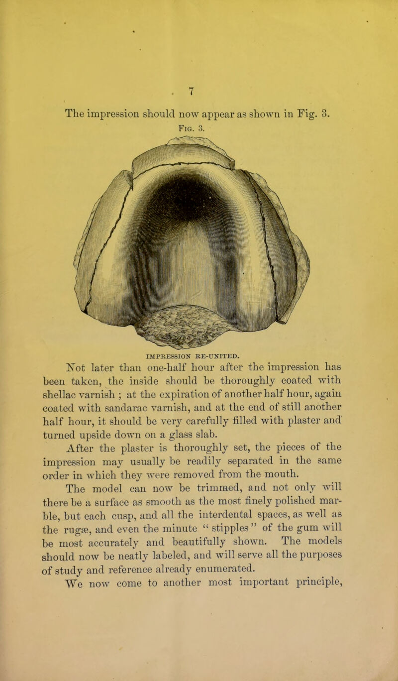 t The impression should now appear as shown in Fig. 8. Fig. 3. IMPRESSION RE-TJNITED. Not later than one-half hour after the impression has been taken, the inside should be thoroughly coated with shellac varnish ; at the expiration of another half hour, again coated with sandarac varnish, and at the end of still another half hour, it should be very carefully filled with plaster and turned upside down on a glass slab. After the plaster is thoroughly set, the pieces of the impression may usually be readily separated in the same order in which they were removed from the mouth. The model can now be trimmed, and not only will there be a surface as smooth as the most finely polished mar- ble, but each cusp, and all the interdental spaces, as well as the rugae, and even the minute “ stipples” of the gum will be most accurately and beautifully shown. The models should now be neatly labeled, and will serve all the purposes of study and reference already enumerated. We now come to another most important principle,