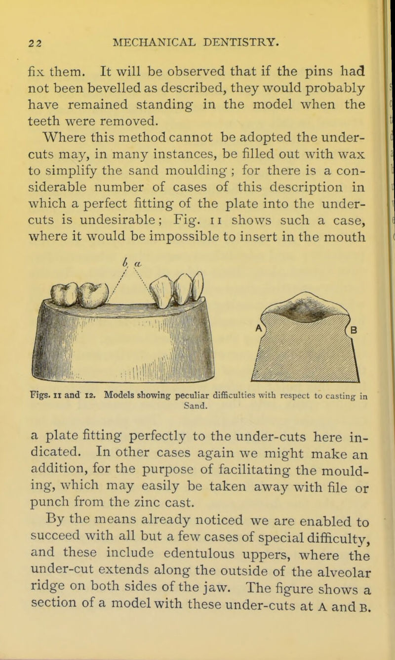 fix them. It will be observed that if the pins had not been bevelled as described, they would probably have remained standing in the model when the teeth were removed. Where this method cannot be adopted the under- cuts may, in many instances, be filled out with wax to simplify the sand moulding ; for there is a con- siderable number of cases of this description in which a perfect fitting of the plate into the under- cuts is undesirable; Fig. 11 shows such a case, where it would be impossible to insert in the mouth 6, (/, Figs. II and 12. Models showing peculiar difficulties with respect to casting in Sand. a plate fitting perfectly to the under-cuts here in- dicated. In other cases again we might make an addition, for the purpose of facilitating the mould- ing, which may easily be taken away with file or punch from the zinc cast. By the means already noticed we are enabled to succeed with all but a few cases of special difficulty, and these include edentulous uppers, where the under-cut extends along the outside of the alveolar ridge on both sides of the jaw. The figure shows a section of a model with these under-cuts at A and b.