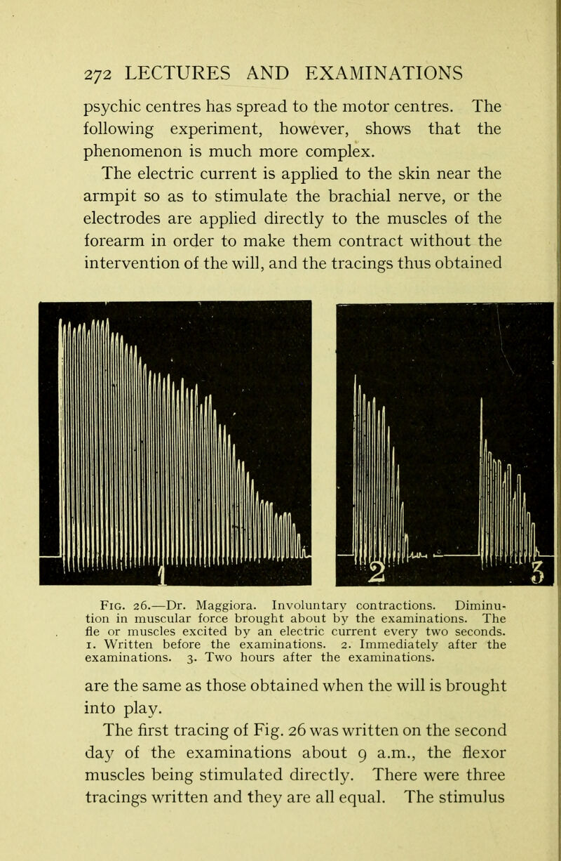 psychic centres has spread to the motor centres. The following experiment, however, shows that the phenomenon is much more complex. The electric current is applied to the skin near the armpit so as to stimulate the brachial nerve, or the electrodes are applied directly to the muscles of the forearm in order to make them contract without the intervention of the will, and the tracings thus obtained Fig. 26.—Dr. Maggiora. Involuntary contractions. Diminu- tion in muscular force brought about by the examinations. The fle or muscles excited by an electric current every two seconds. 1. Written before the examinations. 2. Immediately after the examinations. 3. Two hours after the examinations. are the same as those obtained when the will is brought into play. The first tracing of Fig. 26 was written on the second day of the examinations about 9 a.m., the flexor muscles being stimulated directly. There were three tracings written and they are all equal. The stimulus