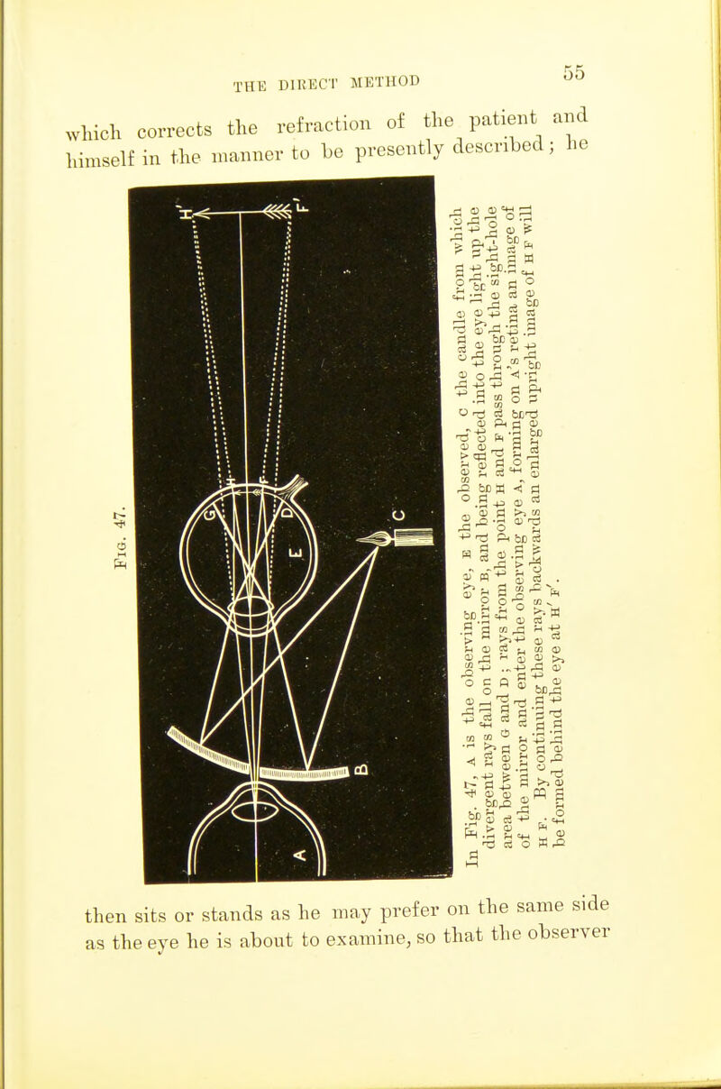 Which corrects the refraction of the patient and himself in the manner to be presently described; he 3 ^ 2 a> ^ ■9 Eg o p ID P< d 01 CD 0) ^ ^ m R <D c3 0) ., -p CD PI >. ID (D 13 - H - P< be cS CD CD S S O o CO ^ S J? n ■ ■> ^ - M - - CD ^  S l >> 2 rfl (D ° = « g tn S a> ^ r,3 +^ CM i:S 5 to CO ^ n ;3 ^ rt O pl a; ^ g g S n3 cS O W Pi then sits or stands as he may prefer on the same side as the eye he is about to examine, so that the observer