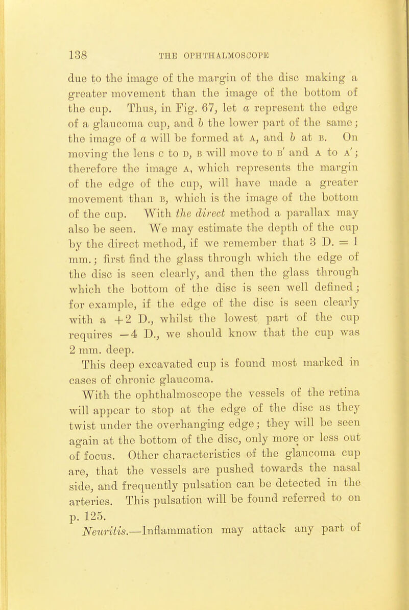 due to the image of the margin of the disc making a greater movement than the imago of the bottom of the cup. Thus, in Fig. 67, let a represent the edge of a glaucoma cup, and h the lower part of the same; the image of a will be formed at a, and h at b. On moving the lens c to d, B will move to b' and A to a' ; therefore the image a, which represents the margin of the edge of the cup, will have made a greater movement than b, which is the image of the bottom of the cup. With the direct method a parallax may also be seen. We may estimate the depth of the cup by the direct method, if we remember that 3 D. = 1 mm.; first find the glass through which the edge of the disc is seen clearly, and then the glass through which the bottom of the disc is seen well defined; for example, if the edge of the disc is seen clearly with a +2 D., whilst the lowest part of the cup requires —4 D., we should know that the cup was 2 mm. deep. This deep excavated cup is found most marked in cases of chronic glaucoma. With the ophthalmoscope the vessels of the retina will appear to stop at the edge of the disc as they twist under the overhanging edge; they will be seen again at the bottom of the disc, only more or less out of focus. Other characteristics of the glaucoma cup are, that the vessels are pushed towards the nasal side, and frequently pulsation can be detected in the arteries. This pulsation will be found referred to on p. 125. Neuritis.—Inflammation may attack any part of