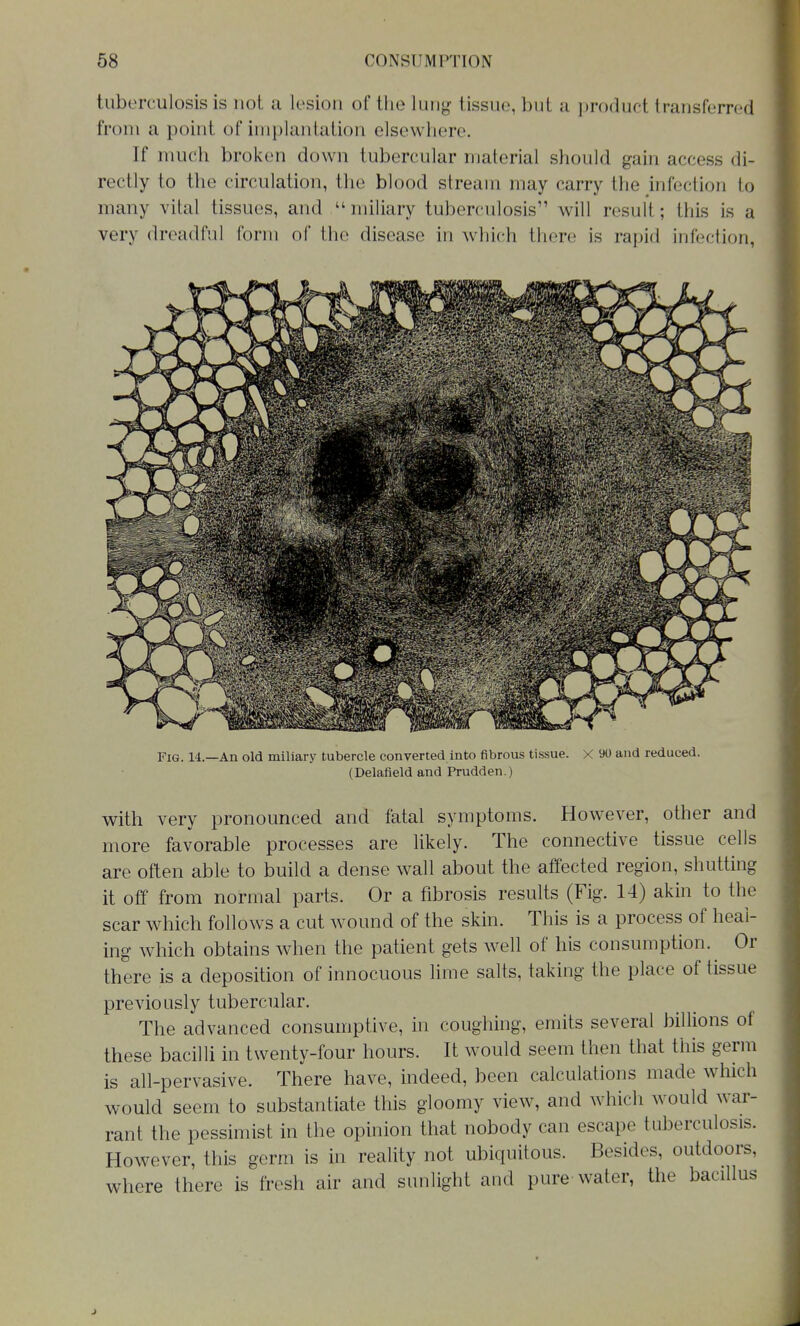 tuberculosis is not a lesion of tlie lung tissue, but a i)roduct transferred from a point of implantation elsewhere. If much broken down tubercular material should gain access di- rectly to the circulation, the blood stream may carry the infection to many vital tissues, and miliary tuberculosis'' will result; this is a very dreadful foriu of the disease in which there is rapid infection, Fig. 14.—An old miliary tubercle converted into fibrous tissue. X 90 and reduced. (Delafield and Prudden.) with very pronounced and fatal symptoms. However, other and more favorable processes are likely. The connective tissue cells are often able to build a dense wall about the affected region, shutting it off from normal parts. Or a fibrosis results (Fig. 14) akin to the scar which follows a cut wound of the skin. This is a process of heal- ing which obtains when the patient gets well of his consumption.^ Or there is a deposition of innocuous lime salts, taking the place of tissue previously tubercular. The advanced consumptive, in coughing, emits several billions of these bacilli in twenty-four hours. It would seem then that this germ is all-pervasive. There have, indeed, been calculations made which would seem to substantiate this gloomy view, and which would war- rant the pessimist in the opinion that nobody can escape tuberculosis. However, this germ is in reality not ubiquitous. Besides, outdoors, where there is fresh air and sunlight and pure-water, the bacillus