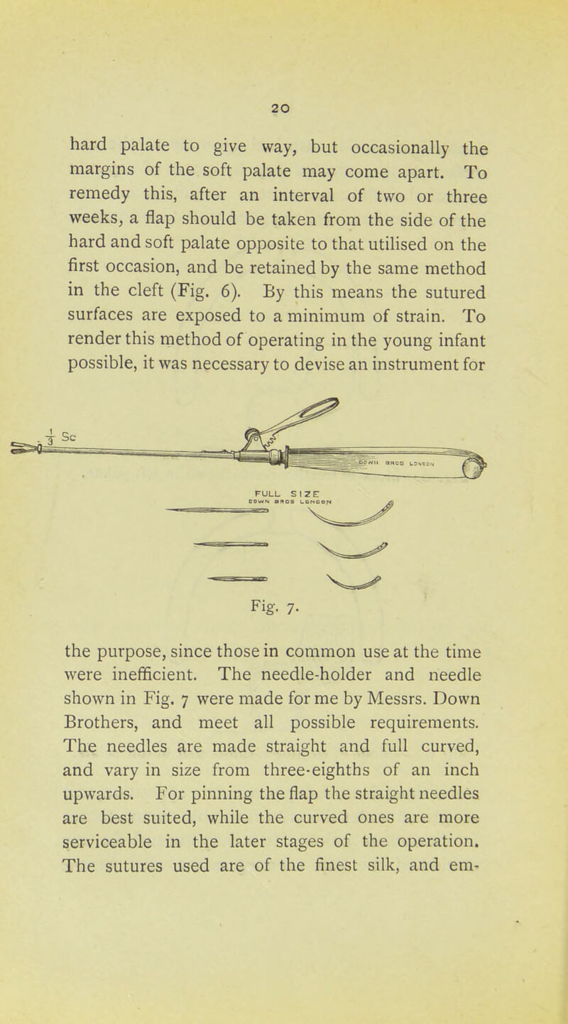 hard palate to give way, but occasionally the margins of the soft palate may come apart. To remedy this, after an interval of two or three weeks, a flap should be taken from the side of the hard and soft palate opposite to that utiHsed on the first occasion, and be retained by the same method in the cleft (Fig. 6). By this means the sutured surfaces are exposed to a minimum of strain. To render this method of operating in the young infant possible, it was necessary to devise an instrument for Fig. 7. the purpose, since those in common use at the time were inefficient. The needle-holder and needle shown in Fig. 7 were made for me by Messrs. Down Brothers, and meet all possible requirements. The needles are made straight and full curved, and vary in size from three-eighths of an inch upwards. For pinning the flap the straight needles are best suited, while the curved ones are more serviceable in the later stages of the operation. The sutures used are of the finest silk, and em-