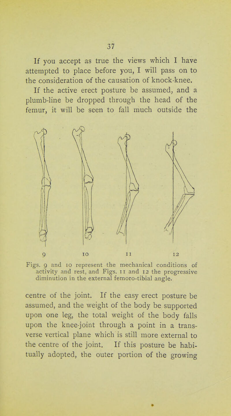 If you accept as true the views which I have attempted to place before you, I will pass on to the consideration of the causation of knock-knee. If the active erect posture be assumed, and a plumb-line be dropped through the head of the femur, it will be seen to fall much outside the 9 lO II 12 Figs. 9 and lo represent the mechanical conditions of activity and rest, and Figs, ii and 12 the progressive diminution in the external femoro-tibial angle. centre of the joint. If the easy erect posture be assumed, and the weight of the body be supported upon one leg, the total weight of the body falls upon the knee-joint through a point in a trans- verse vertical plane which is still more external to the centre of the joint. If this posture be habi- tually adopted, the outer portion of the growing