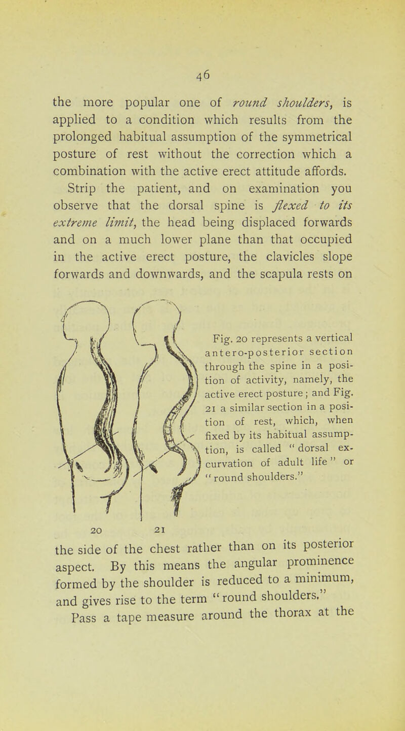 the more popular one of round shoulders^ is applied to a condition which results from the prolonged habitual assumption of the symmetrical posture of rest without the correction which a combination with the active erect attitude affords. Strip the patient, and on examination you observe that the dorsal spine is flexed to its extreme limit, the head being displaced forwards and on a much lower plane than that occupied in the active erect posture, the clavicles slope forwards and downwards, and the scapula rests on Fig. 20 represents a vertical antero-posterior section through the spine in a posi- tion of activity, namely, the active erect posture ; and Fig. 21 a similar section in a posi- tion of rest, which, when fixed by its habitual assump- tion, is called  dorsal ex- curvation of adult life or  round shoulders. 20 21 the side of the chest rather than on its posterior aspect. By this means the angular prominence formed by the shoulder is reduced to a minimum, and gives rise to the term  round shoulders. Pass a tape measure around the thorax at the