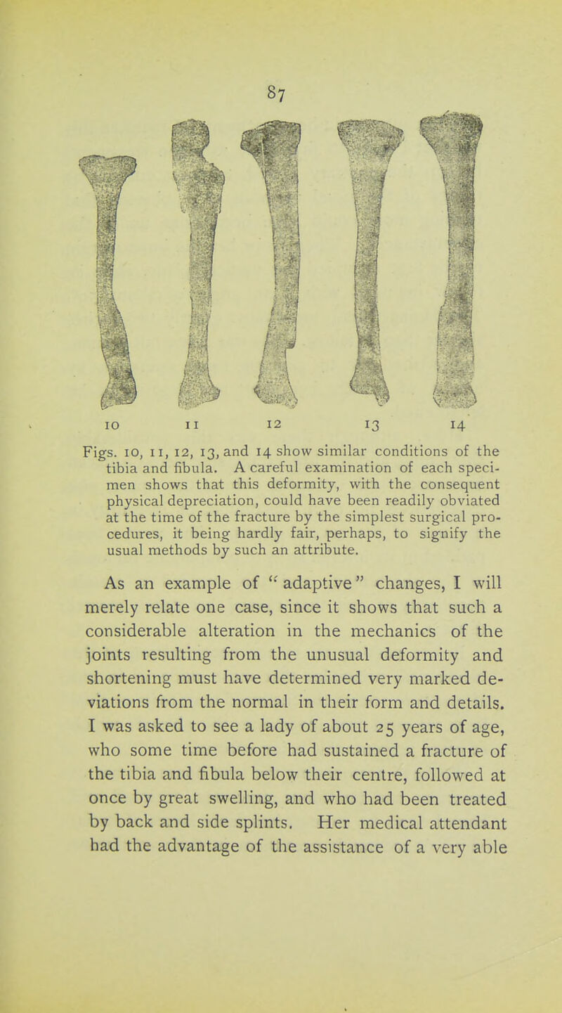 Figs. 10, II, 12, 13, and 14 show similar conditions of the tibia and fibula. A careful examination of each speci- men shows that this deformity, with the consequent physical depreciation, could have been readily obviated at the time of the fracture by the simplest surgical pro- cedures, it being hardly fair, perhaps, to signify the usual methods by such an attribute. As an example of adaptive changes, I will merely relate one case, since it shows that such a considerable alteration in the mechanics of the joints resulting from the unusual deformity and shortening must have determined very marked de- viations from the normal in their form and details. I was asked to see a lady of about 25 years of age, who some time before had sustained a fracture of the tibia and fibula below their centre, followed at once by great swelling, and who had been treated by back and side splints. Her medical attendant had the advantage of the assistance of a very able