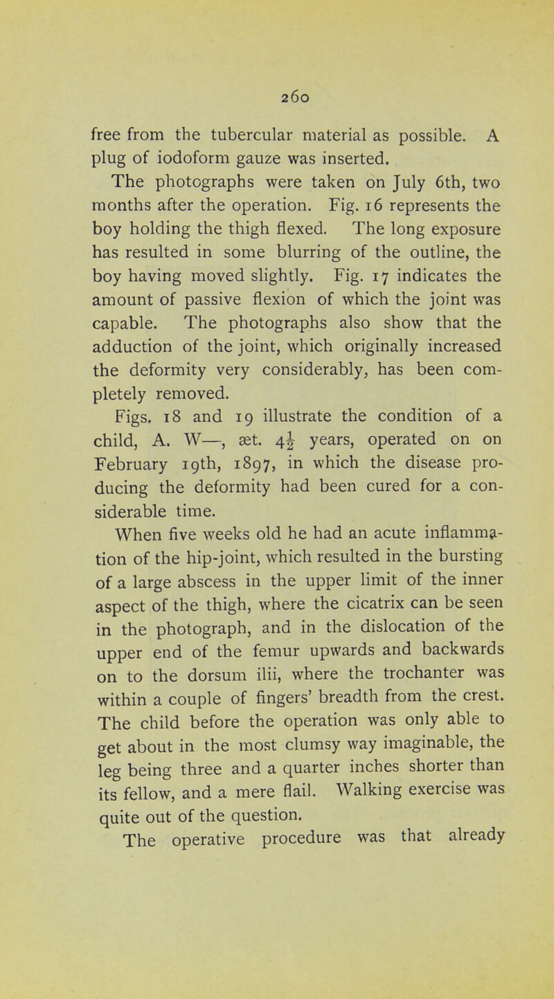 free from the tubercular material as possible. A plug of iodoform gauze was inserted. The photographs were taken on July 6th, two months after the operation. Fig. i6 represents the boy holding the thigh flexed. The long exposure has resulted in some blurring of the outline, the boy having moved slightly. Fig. 17 indicates the amount of passive flexion of which the joint was capable. The photographs also show that the adduction of the joint, which originally increased the deformity very considerably, has been com- pletely removed. Figs. 18 and 19 illustrate the condition of a child, A. W—, aet. 4^ years, operated on on February 19th, 1897, in which the disease pro- ducing the deformity had been cured for a con- siderable time. When five weeks old he had an acute inflamma- tion of the hip-joint, which resulted in the bursting of a large abscess in the upper limit of the inner aspect of the thigh, where the cicatrix can be seen in the photograph, and in the dislocation of the upper end of the femur upwards and backwards on to the dorsum ilii, where the trochanter was within a couple of fingers' breadth from the crest. The child before the operation was only able to get about in the most clumsy way imaginable, the leg being three and a quarter inches shorter than its fellow, and a mere flail. Walking exercise was quite out of the question. The operative procedure was that already