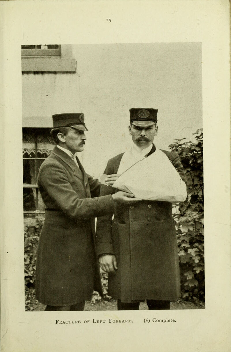 Fracture of Left Forearm. (b) Complete.