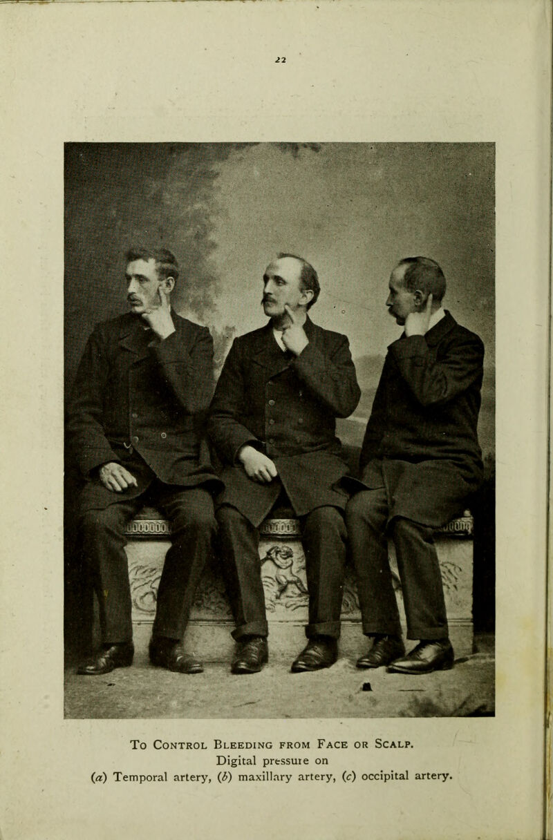 To Control Bleeding from Face or Scalp. Digital pressure on (a) Temporal artery, (b) maxillary artery, (c) occipital artery.