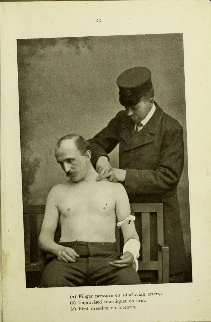 (a) Finger pressure on subclavian artery. (b) Improvised tourniquet on arm. (c) First dressing on forearm. .