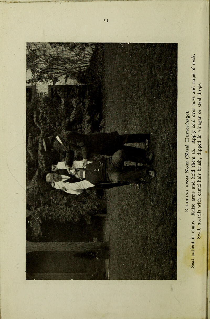 from Nose (Nasal Haemorrhage).