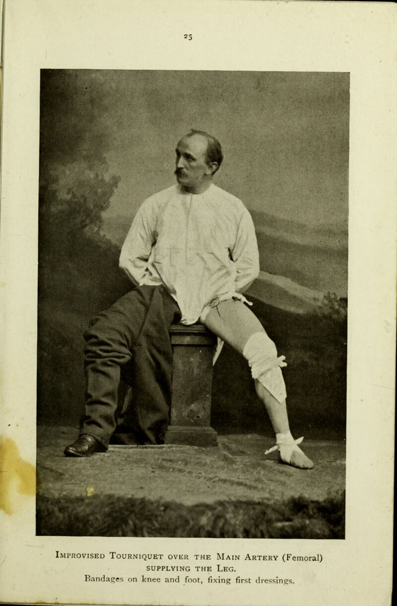 Improvised Tourniquet over the Main Artery (Femoral) SUPPLYING THE LEG. Bandages on knee and foot, fixing first dressings.