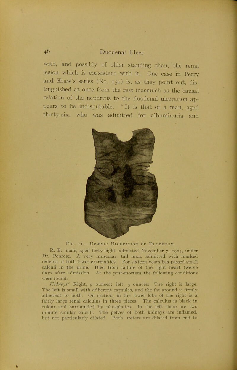 with, and possibly of older standing than, the renal lesion which is coexistent with it. One case in Perry and Shaw's series (No. 151) is, as they point out, dis- tinguished at once from the rest inasmuch as the causal relation of the nephritis to the duodenal ulceration ap- pears to be indisputable. It is that of a man, aged thirty-six, who was admitted for albuminuria and Fig. II.—Uremic Ulceration of Duodenum. R. B., male, aged forty-eight, admitted November 7, 1904, under Dr. Penrose. A very muscular, tall man, admitted with marked oedema of both lower extremities. For sixteen years has passed small calculi in the tirine. Died from failure of the right heart twelve days after admission At the post-mortem the following conditions were found: Kidneys: Right, 9 ounces; left, 3 ounces. The right is large. The left is small with adherent capsules, and tlie fat around is firmly adherent to both. On section, in the lower lobe of the right is a fairly large renal calculus in three pieces. The calculus is black in colour and surrounded by phosphates. In the left there are two minute similar calculi. The pelves of both kidneys are inflamed, but not particularly dilated. Both ureters are dilated from end to