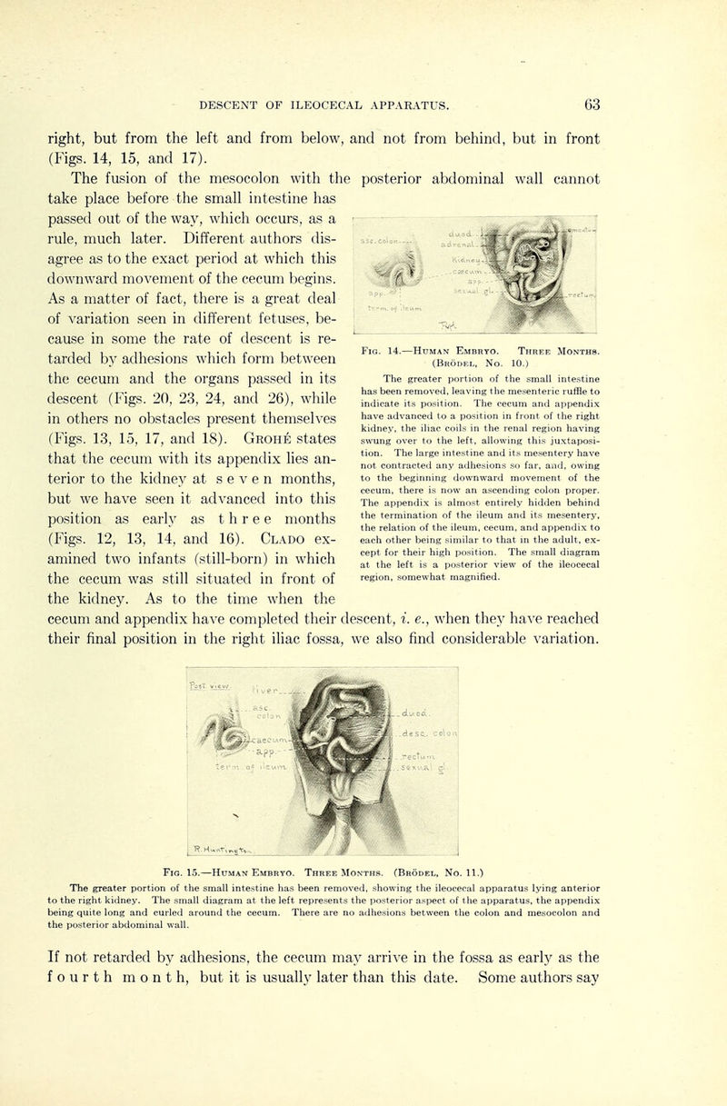 Three Months. 10.) right, but from the left and from below, and not from behind, but in front (Figs. 14, 15, and 17). The fusion of the mesocolon with the posterior abdominal wall cannot take place before the small intestine has passed out of the way, which occurs, as a rule, much later. Different authors dis- agree as to the exact period at which this downward movement of the cecum begins. As a matter of fact, there is a great deal of variation seen in different fetuses, be- cause in some the rate of descent is re- tarded by adhesions which form between the cecum and the organs passed in its descent (Figs. 20, 23, 24, and 26), while in others no obstacles present themselves (Figs. 13, 15, 17, and 18). Grohe states that the cecum with its appendix lies an- terior to the kidne}^ at seven months, but we have seen it advanced into this position as early as three months (Figs. 12, 13, 14, and 16). Clado ex- amined two infants (still-born) in which the cecum was still situated in front of the kidney. As to the time when the cecum and appendix have completed their descent, i. e., when they have reached their final position in the right iliac fossa, we also find considerable variation. Fig. 14.—Human Embryo. (Brodel, No. The greater portion of the small intestine has been removed, leaving the me.senteric ruffle to indicate its position. The cecum and appendix have advanced to a position in front of the right kidney, the iliac coils in the renal region having swung over to the left, allowing this juxtaposi- tion. The large intestine and its mesentery have not contracted any adhesions so far, and, owing to the beginning downward movement of the cecum, there is now an ascending colon proper. The appendix is almost entirely hidden behind the termination of the ileum and its mesentery, the relation of the ileum, cecum, and appendix to each other being similar to that in the adult, ex- cept for their high position. The small diagram at the left is a posterior view of the ileocecal region, somewhat magnified. Fig. 15.—Human Embryo. Three Months. (Brodel, No. 11.) The greater portion of the small intestine has been removed, showing the ileocecal apparatus lying anterior to the right kidney. The small diagram at the left represents the posterior aspect of the apparatus, the appendix being quite long and curled around the cecum. There are no adhesions between the colon and mesocolon and the posterior abdominal wall. If not retarded by adhesions, the cecum may arrive in the fossa as early as the fourth month, but it is usually later than this date. Some authors say