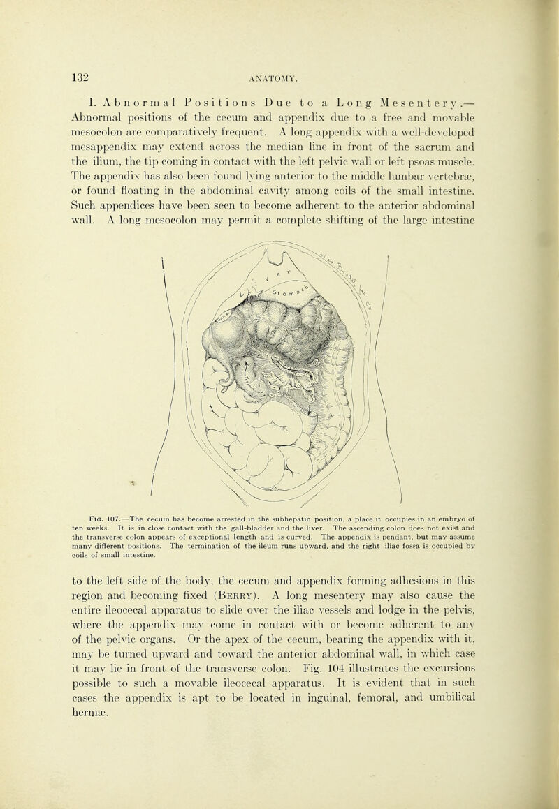 I. Abnormal Positions Due to a Long Mesentery.— Abnormal positions of the cecum and appendix due to a free and movable mesocolon are comparatively frequent. A long appendix with a well-de\-eloped mesappendix may extend across the median line in front of the sacrum and the ilium, the tip coming in contact with the left pelvic wall or left psoas muscle. The appendix has also been found lying anterior to the middle lumbar vertebrae, or found floating in the abdominal cavit)^ among coils of the small intestine. Such appendices have been seen to become adherent to the anterior abdominal wall. A long mesocolon may permit a complete shifting of the large intestine Fig. 107.—The cecum has become arrested in the subhepatic position, a place it occupies in an embryo of ten weeks. It is in close contact with the gall-bladder and the liver. The ascending; colon does not exist and the transverse colon appears of exceptional length and is curved. The appendix is pendant, but may assume many different positions. The termination of the ileum runs upward, and the right iliac fossa is occupied by coils of small intestine. to the left side of the body, the cecum and appendix forming adhesions in this region and becoming fixed (Berry). A long mesentery may also cause the entire ileocecal apparatus to slide over the iliac vessels and lodge in the pelvis, where the appendix ma}' come in contact with or become adherent to any of the pelvic organs. Or the apex of the cecum, bearing the appendix with it, may be turned upward and toward the anterior abdominal wall, in which case it may lie in front of the transverse colon. Fig. 104 illustrates the excursions possible to such a movable ileocecal apparatus. It is evident that in such cases the appendix is apt to be located in inguinal, femoral, and umbilical herniae.