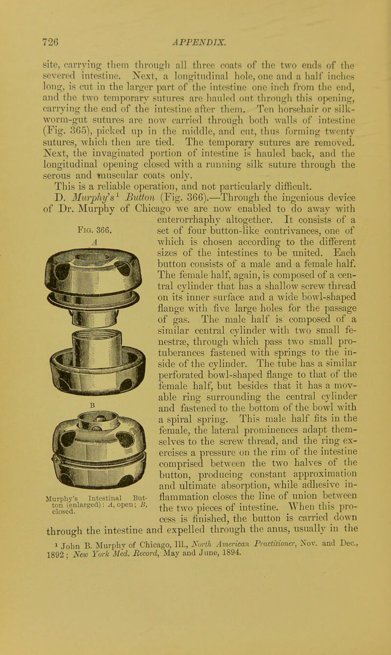 site, carrying them through all three coats of the two ends of the severed intestine. Next, a longitudinal hole, one and a half inches long, is cut in the larger part of the intestine one inch from the end, and the two temporary sutures arc hauled out through this opening, carrying the end of the intestine after them. Ten horsehair or silk- worm-gut sutures are now carried through both walls of intestine (Fig. 365), picked up in the middle, and cut, thus forming twenty sutures, which then are tied. The temporary sutures are removed. Next, the invaginated portion of intestine is hauled back, and the longitudinal opening closed with a running silk suture through the serous and muscular coats only. This is a reliable operation, and not particularly difficult. D. Murphy's1 Button (Fig. 366).—Through the ingenious device of Dr. Murphy of Chicago we are now enabled to do away with enterorrhaphy altogether. It consists of a set of four button-like contrivances, one of which is chosen according to the different sizes of the intestines to be united. Each button consists of a male and a female half. The female half, again, is composed of a cen- tral cylinder that has a shallow screw thread on its inner surface and a wide bowl-shaped flange with five large holes for the passage of gas. The male half is composed of a similar central cylinder with two small fe- nestra?, through which pass two small pro- tuberances fastened with springs to the in- side of the cylinder. The tube has a similar perforated bowl-shaped flange to that of the female half, but besides that it has a mov- able ring surrounding the central cylinder and fastened to the bottom of the bowl with a spiral spring. This male half fits in the female, the lateral prominences adapt them- selves to the screw thread, and the ring ex- ercises a pressure on the rim of the intestine comprised between the two halves of the button, producing constant approximation and ultimate absorption, while adhesive in- flammation closes the line of union between the two pieces of intestine. When this pro- cess is finished, the button is carried down through the intestine and expelled through the anus, usually in the 1 John B. Murphy of Chicago, 111., North American Practitioner, Nov. and Dec, 1892 ; New York Med. Record, May and June, 1894. Murphy's Intestinal But- ton (enlarged): A, open; B, closed.
