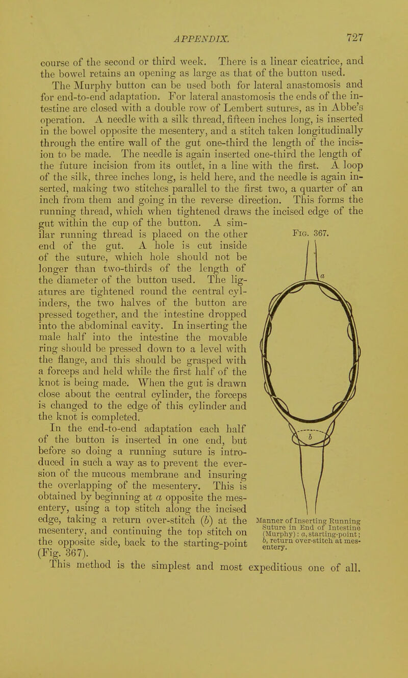 course of the second or third week. There is a linear cicatrice, and the bowel retains an opening as large as that of the button used. The Murphy button can be used both for lateral anastomosis and for end-to-end adaptation. For lateral anastomosis the ends of the in- testine are closed with a double row of Lembert sutures, as in Abbe's operation. A needle with a silk thread, fifteen inches long, is inserted in the bowel opposite the mesentery, and a stitch taken longitudinally through the entire wall of the gut one-third the length of the incis- ion to be made. The needle is again inserted one-third the length of the future incision from its outlet, in a line with the first. A loop of the silk, three inches long, is held here, and the needle is again in- serted, making two stitches parallel to the first two, a quarter of an inch from them and going in the reverse direction. This forms the running thread, which when tightened draws the incised edge of the gut within the cup of the button. A sim- ilar running thread is placed on the other Fig. 367. end of the gut. A hole is cut inside I of the suture, which hole should not be longer than two-thirds of the length of / the diameter of the button used. The lig- -^f^^iL^ atures are tightened round the central cyl- /7r^ inders, the two halves of the button are f/W pressed together, and the intestine dropped ii Yl into the abdominal cavity. In inserting the jj /l\ male half into the intestine the movable If VI ring should be pressed down to a level with III I) the flange, and this should be grasped with vL I a forceps and held while the first half of the \l) 4 knot is being made. When the gut is drawn (\ l/ close about the central cylinder, the forceps // is changed to the edge of this cylinder and /jy the knot is completed. n^f In the end-to-end adaptation each half \. JJ of the button is inserted in one end, but ^H^t-^* before so doing a running suture is intro- \ duced in such a way as to prevent the ever- I sion of the mucous membrane and insuring I / the overlapping of the mesentery. This is \ / obtained by beginning at a opposite the mes- \ / entery, using a top stitch along the incised \ f Manner of Inserting Running Suture in End of Intestine (Murphy): a,starting-point; 6, return over-stitch at mes- This method is the simplest and most expeditious one of all.