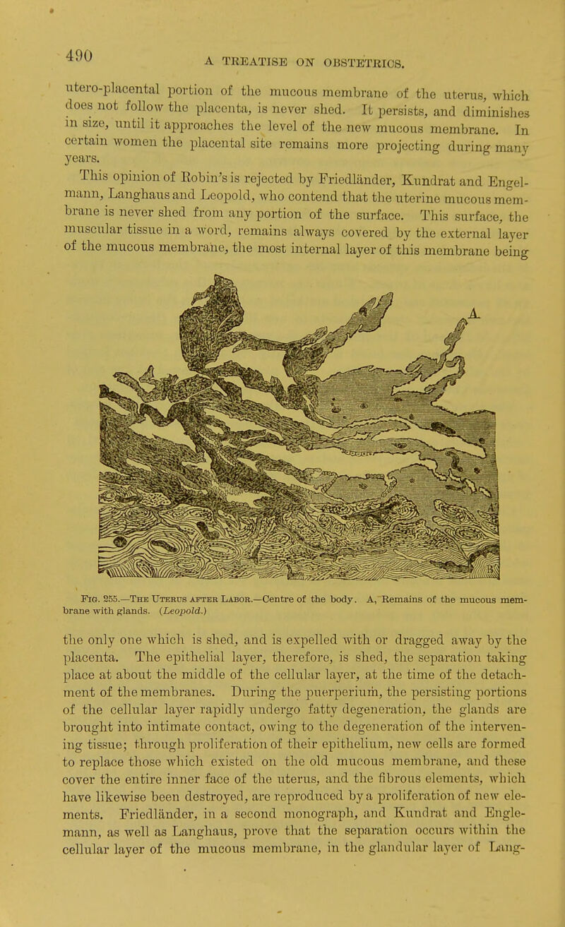 A TREATISE ON OBSTETEI08. iitero-placental portioii of the mucous membrane of the uterus, which does not follow the placenta, is never shed. It persists, and diminishes m size, until it approaclies the level of the new mucous membrane. In certain women the placental site remains more projecting during many years. This opinion of Robin's is rejected by Friedlander, Kundrat and Engel- mann, Langhausand Leopold, who contend that tlie uterine mucous mem- brane is never shed from any portion of the surface. This surface, the muscular tissue in a word, remains always covered by the external layer of the mucous membrane, the most internal layer of this membrane being Fig. 255.—The Uterus after Labor.—Centre of the body, brane with glands. {Leopold.) A,'Eemains of the mucous mem- the only one which is shed, and is expelled with or dragged away by the placenta. The epithelial layer, therefore, is shed, the separation taking place at about the middle of the cellular layer, at the time of the detach- ment of the membranes. During the puerperiiiih, the persisting portions of the cellular layer rapidly undergo fatty degeneration, the glands are brought into intimate contact, owing to the degeneration of the interven- ing tissue; through proliferation of their epithelium, new cells are formed to replace those which existed on the old mucous membrane, and these cover the entire inner face of the uterus, and the fibrous elements, which have likewise been destroyed, are reproduced by a proliferation of new ele- ments. Friedlander, in a second monograph, and Kundrat and Engle- mann, as well as Langhaus, prove that the separation occurs Avithin the cellular layer of the mucous membrane, in the glandular layer of Lang-