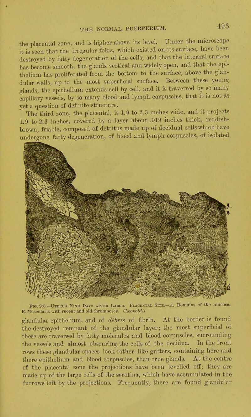 the placental zone, and is higher above its level. Under the microscope it is seen that the irregular folds, which existed on its surface, have been destroyed by fatty degeneration of the cells, and that the internal surface has become smooth, the glands vertical and widely open, and that the epi- thelium has proliferated from the bottom to the surface, above the glan- dular walls, up to the most superficial surface. Between these young glands, the epithelium extends cell by cell, and it is traversed by so many capillary vessels, by so many blood and lymph corpuscles, that it is not as yet a question of definite structure. The third zone, the placental, is 1.9 to 2.3 inches wide, and it projects 1.9 to 2.3 inches, covered by a layer about .019 inches thick, reddish- brown, friable, composed of detritus made up of decidual cells which have undergone fatty degeneration, of blood and lymph corpuscles, of isolated Fig. 258.—Uterus Nine Days after Labor. Placental Site.—4, Remains of the mucosa. B. Muscularis with recent and old thromboses. (^Leopold.) glandular epithelium, and of debris of fibrin. At the border is found the destroyed remnant of the glandular layer; the most superficial of these are traversed by fatty molecules and blood corpuscles, surrounding the vessels and almost obscuring the cells of the decidua. In the front rows these glandular spaces look rather like gutters, containing here and there epithelium and blood corpuscles, than true glands. At the centre of the placental zone the projections have been levelled off; they ai-e made up of the large cells of the serotina, which have accumulated in the furrows left by the projections. Frequently, there are found glandular