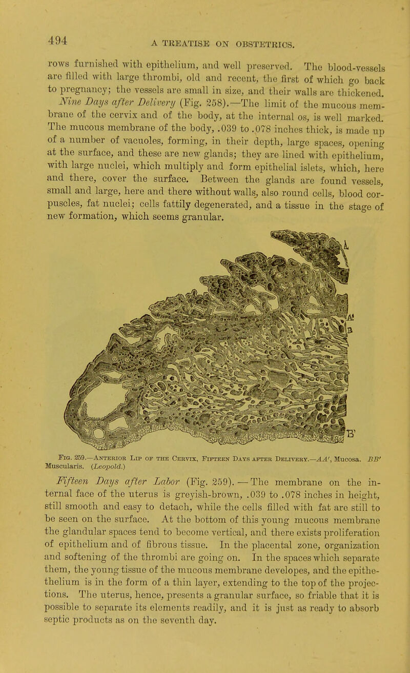 rows fiu-nislied with epithelium, and well i^reservcd. The blood-vessels are filled with large thrombi, old and recent, tlie first of which go back to pregnancy; the vessels are small in size, and their walls are tliickened, mm Dmjs after Delivery (Pig. 258).—The limit of the mucous mem- brane of the cervix and of the body, at the internal os, is well marked. The mucous membrane of the body, .039 to .078 inches thick, is made up of a number of vacuoles, forming, in their depth, large spaces, opening at the surface, and these are new glands; they are lined with epithelium, with large nuclei, which multiply and form epithelial islets, which, here and there, cover the surface. Between the glands are found vessels, small and large, here and there without walls^ also round cells, blood cor- puscles, fat nuclei; cells fattily degenerated, and a tissue in the stage of new formation, which seems granular. Fig. 259.—Anterior Lip op the Cervix, Fifteen Days after Dblivbrt.—^4', Mucosa. BB' Muscularis. (Leopold.) Fifteen Days after Labor (Pig. 259). — The membrane on the in- ternal face of the uterus is greyish-brown, .039 to .078 inches in height, still smooth and easy to detach, while the cells filled with fat are still to be seen on the surface. At the bottom of this young mucous membrane the glandular spaces tend to become vertical, and there exists proliferation of epithelium and of fibrous tissue. In the placental zone, organization and softening of the thrombi are going on. In the spaces which separate them, the young tissue of the mucous membrane developes, and the epithe- thelium is in the form of a thin layer, extending to the top of the projec- tions. The uterus, hence, presents a granular surface, so friable that it is possible to separate its elements readily, and it is just as ready to absorb septic products as on the seventh day.