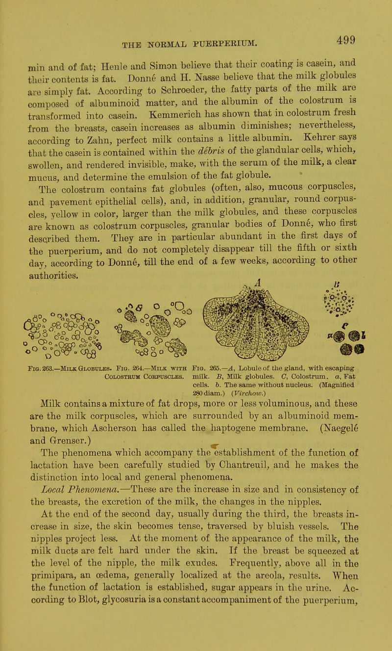 min and of fat; Heule and Simon believe that their coating is casein, and their contents is fat. Donne and H. Nasse believe that the milk globules are simply fat. According to Schroeder, the fatty parts of the milk are composed of albuminoid matter, and the albumin of the colostrum is transformed into casein. Kemmerich has shown that in colostrum fresh from the breasts, casein increases as albumin diminishes; nevertheless, according to Zahn, perfect milk contains a little albumin. Kehrer says that the casein is contained within the debris of the glandular cells, which, swollen, and rendered invisible, make, with the serum of the milk, a clear mucus, and determine the emulsion of the fat globule. The colostrum contains fat globules (often, also, mucous corpuscles, and pavement epithelial cells), and, in addition, granular, round corpus- cles, yellow m color, larger than the milk globules, and these corpuscles are known as colostrum corpuscles, granular bodies of Donne, who fii'st described them. They are in particular abundant in the first days of the puerperium, and do not completely disappear till the fifth or sixth day, according to Donne, tUl the end of a few weeks, according to other authorities. O 5 6 o °0 Fig. 263.—Milk Globules. Fig. 264.—^Milk with Fig. 265.—.4, Lobule of the gland, with escaping CoLOSTiiuM CoEPUSCLES. mUk. By Milk globules. C, Colostrum, a. Fat cells, b. The same without nucleus. (Magnified 280diam.) (Virchow.) Milk contains a mixture of fat drops, more or less voluminous, and these are the milk corpuscles, which are surrounded by an albuminoid mem- brane, which Ascherson has called the haptogene membrane. (Naegele and Grenser.) The phenomena which accompany the establishment of the function of lactation have been carefully studied by Ohantreuil, and he makes the distinction into local and general phenomena. Local Phenomena,—These are the increase in size and in consistency of the breasts, the excretion of the milk, the changes in the nipples. At the end of the second day, usually during the third, the breasts in- crease in size, the skin becomes tense, traversed by bluish vessels. The nipples project less. At the moment of the appearance of the milk, the milk ducts are felt liard under the skin. If the breast be squeezed at the level of the nipple, the milk exudes. Frequently, above all in the primipara, an oedema, generally localized at the areola, results. When the function of lactation is established, sugar appears in the urine. Ac- cording to Blot, glycosuria is a constant accompaniment of the puerperium,