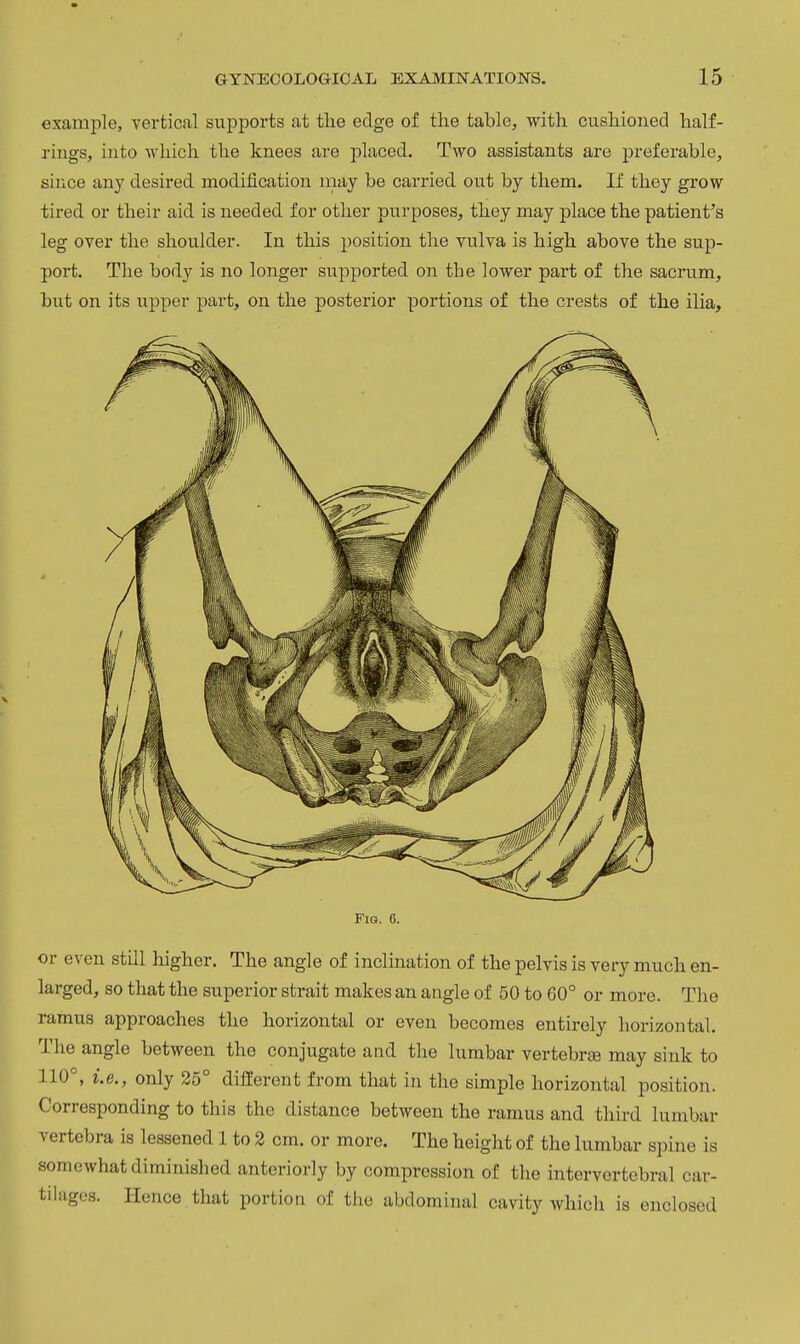 example, vertical supports at tlie edge of the table, with cushioned half- rings, into which the knees are placed. Two assistants are preferable, sirice any desired modification may be carried out by them. If they grow tired or their aid is needed for other purposes, they may place the patient's leg over the shoulder. In this position the vulva is high above the sup- port. The body is no longer supported on the lower part of the sacrum, but on its upper part, on the posterior portions of the crests of the ilia. Fig. 6. or even still higher. The angle of inclination of thepelvisis very much en- larged, so that the superior strait makes an angle of 50 to 60° or more. The ramus approaches the horizontal or even becomes entirely horizontal. The angle between the conjugate and the lumbar vertebrae may sink to 110°, i.e., only 25° different from that in the simple horizontal position. Corresponding to this the distance between the ramus and third lumbar vertebra is lessened 1 to 2 cm. or more. The height of the lumbar spine is somewhat diminished anteriorly by compression of the intervertebral car- tilages. Hence that portion of the abdominal cavity which is enclosed